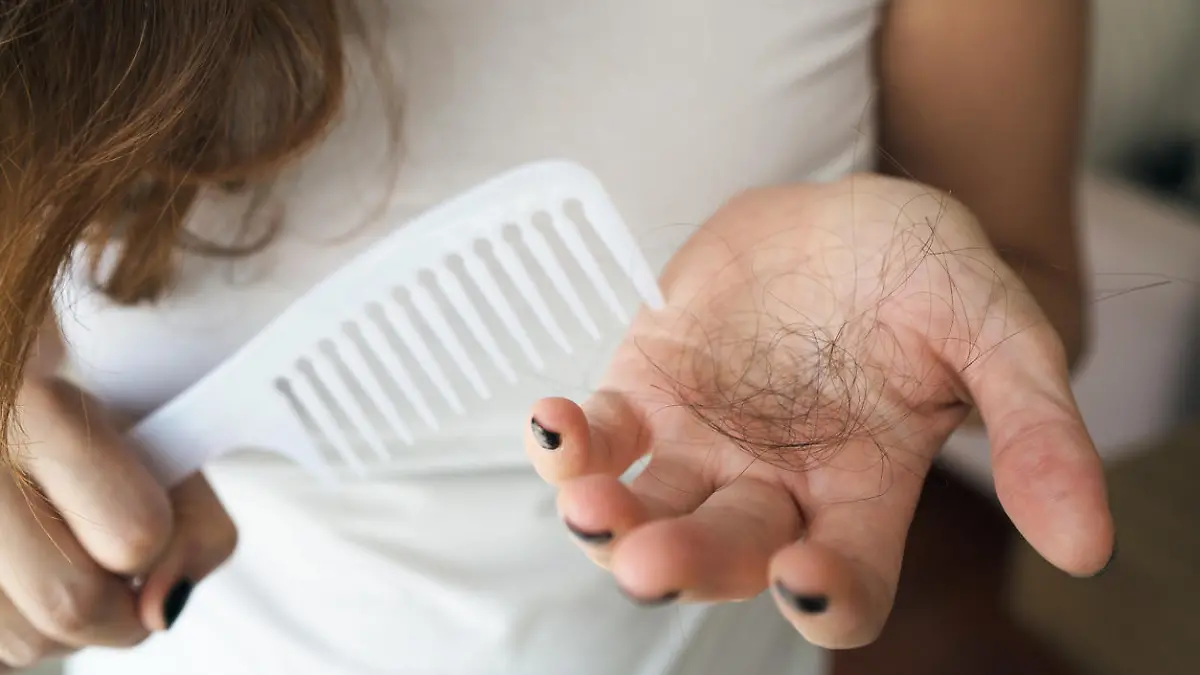 Frau mit Haarausfall