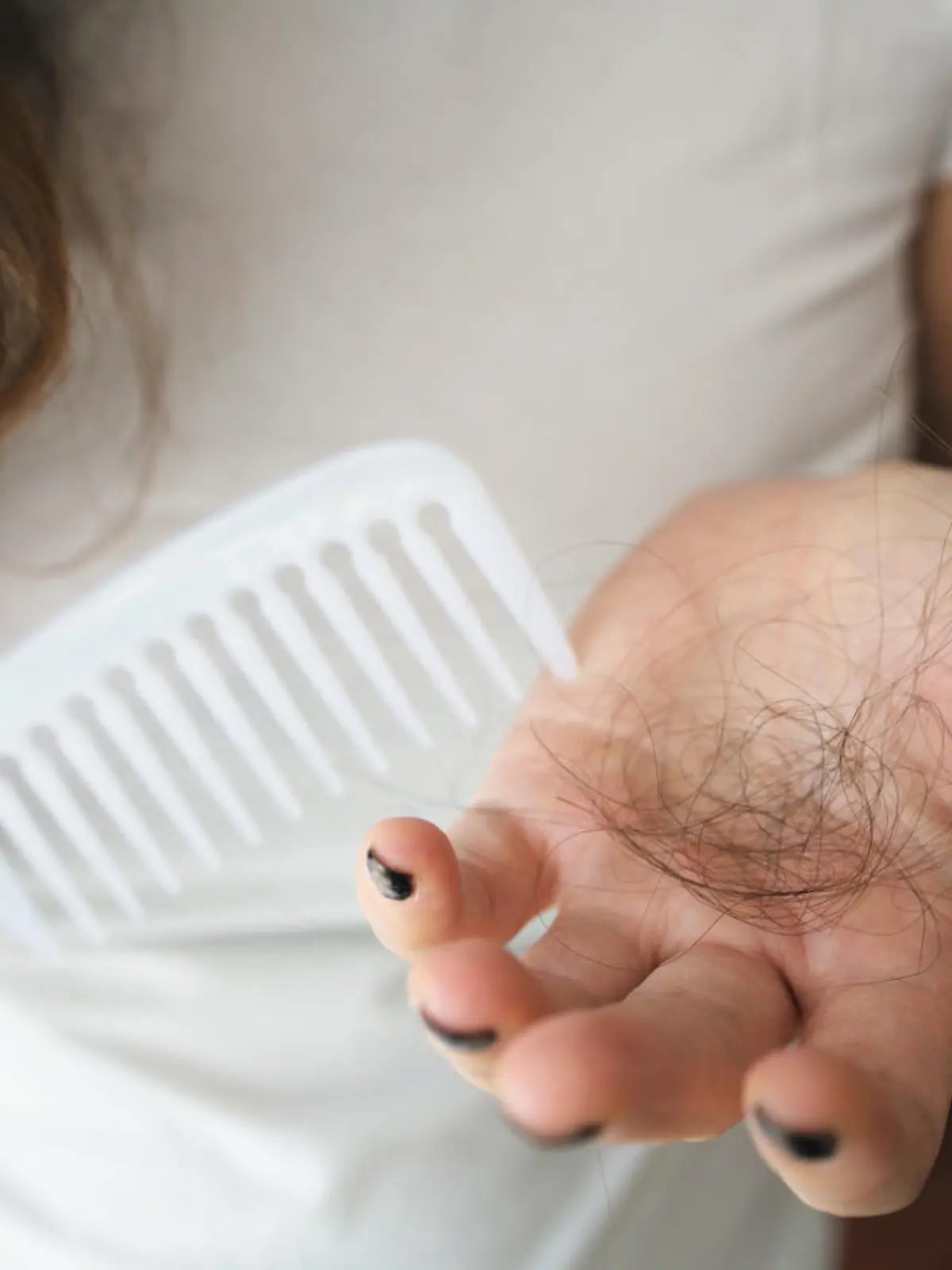 Frau mit Haarausfall