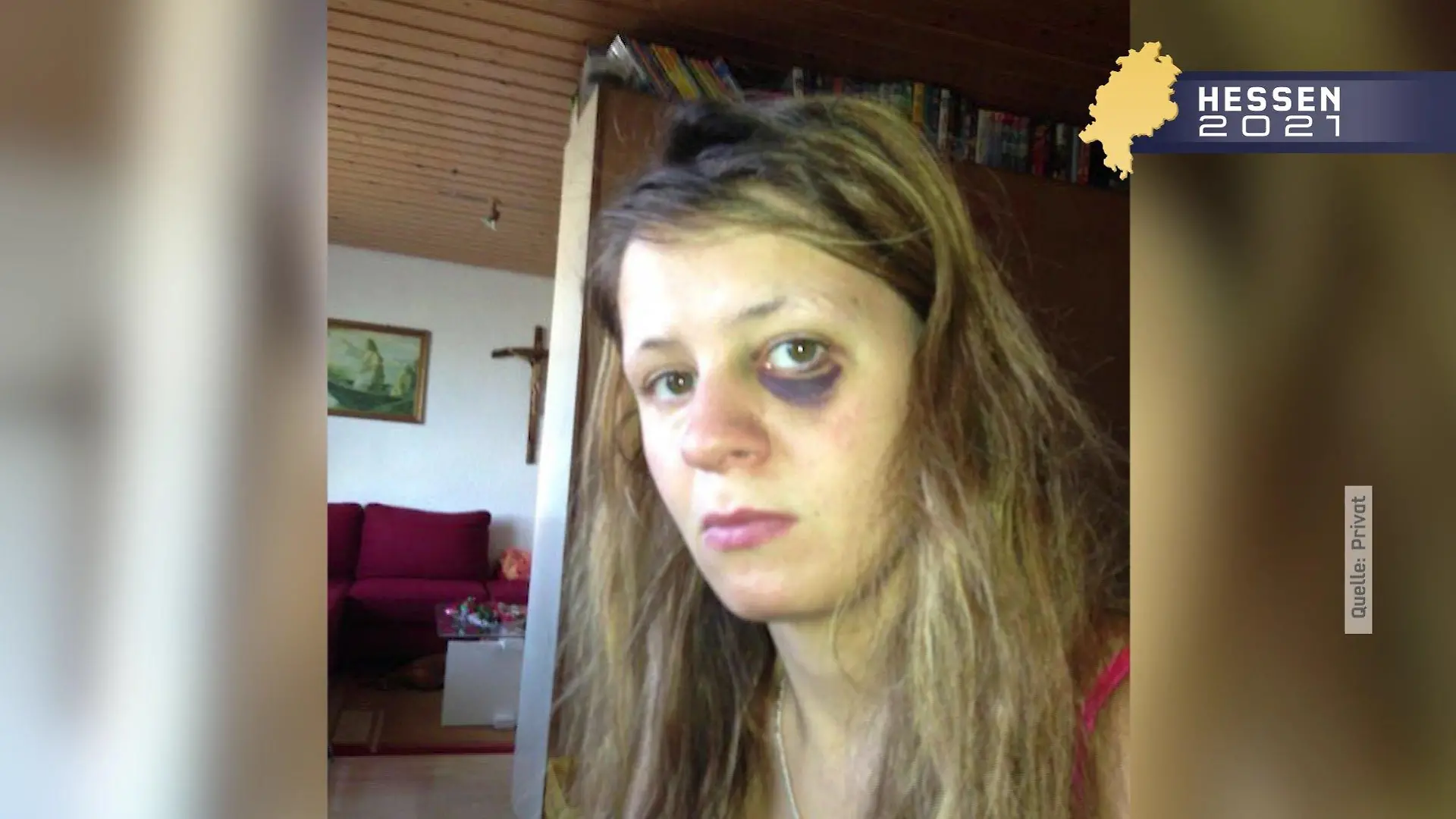 Svenja Beck nach dem Angriff ihres damaligen Freundes