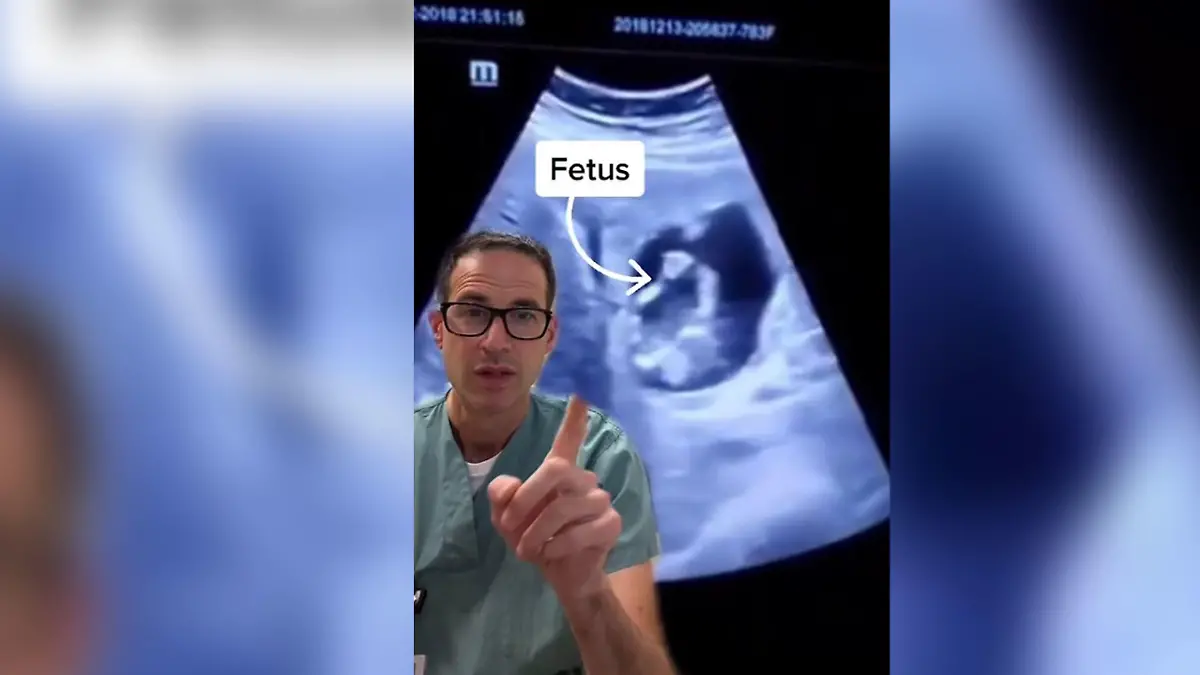 Auf Tiktok teilt der Arzt den Fall mit seinen Followern