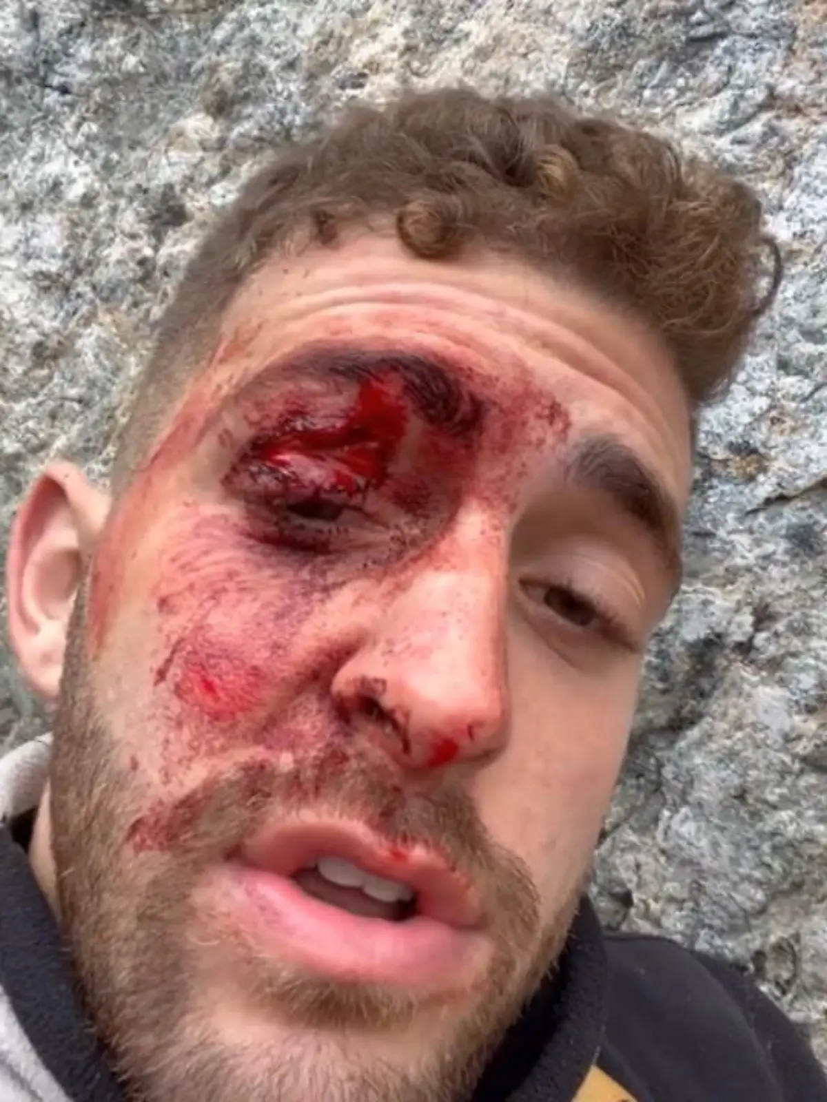 Eitan Shaked (23) ist sich sicher, dass er sterben muss. Der 23-Jährige hat sich bei einem Sturz auf einem Gletscher so schwer verletzt, dass er keine Hoffnung auf Rettung mehr hat. Mit dem Handy nimmt er ein Abschiedsvideo für seine Mutter auf. Doch wie durch ein Wunder überlebt der Israeli – obwohl er 24 Stunden in der Kälte ausharren muss und sich Becken und Ellenbogen gebrochen hat.