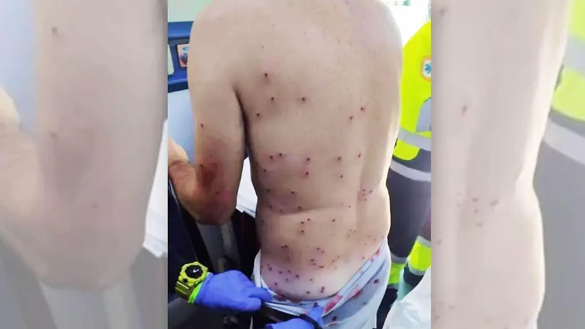 Ein Jäger hat diese Mountainbiker angeschossen, weil er ihn angeblich mit einem Kaninchen verwechselt hat.