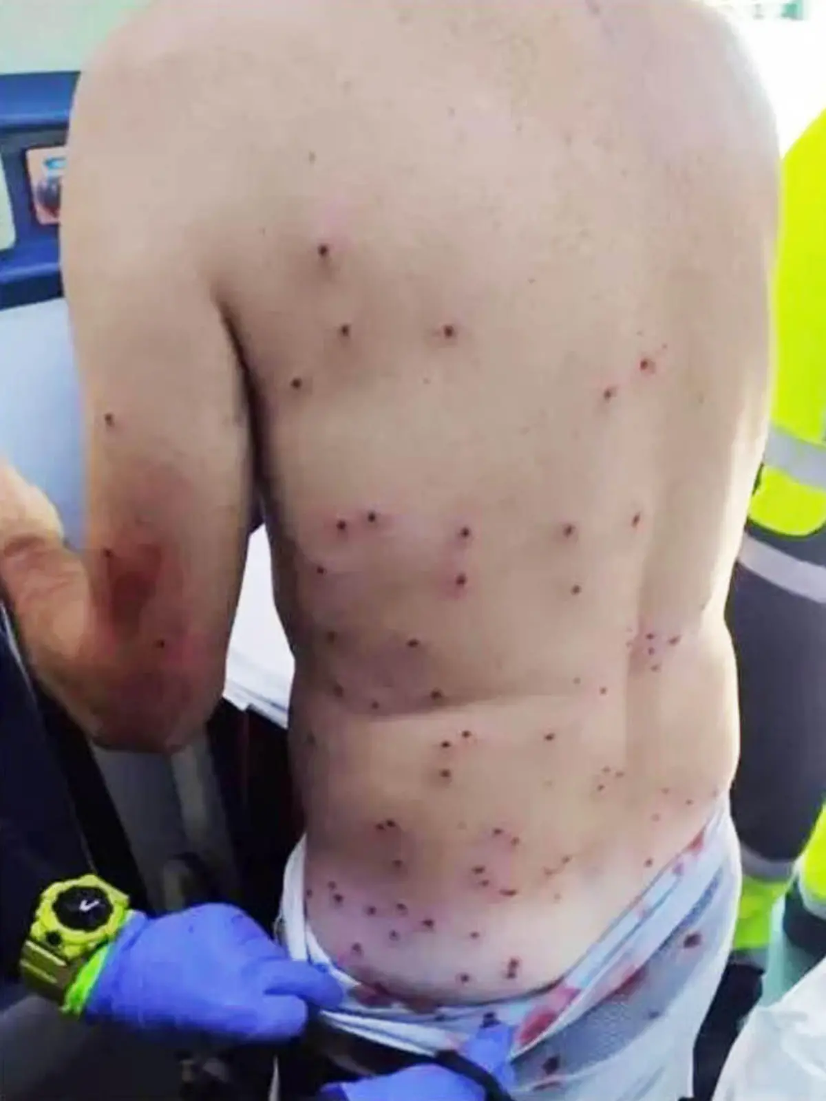 Ein Jäger hat diese Mountainbiker angeschossen, weil er ihn angeblich mit einem Kaninchen verwechselt hat.