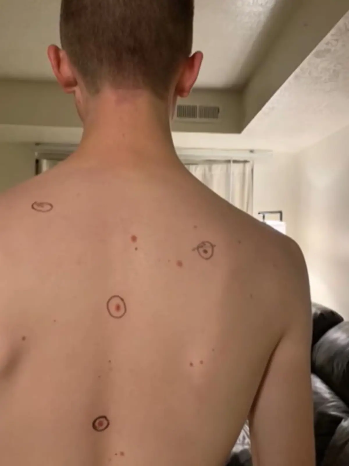 Eine Frau aus den USA wollte vor der Untersuchung ihres Mannes auf Nummer sicher gehen und hat einfach alle Muttermale auf seinem Körper eingekreist.