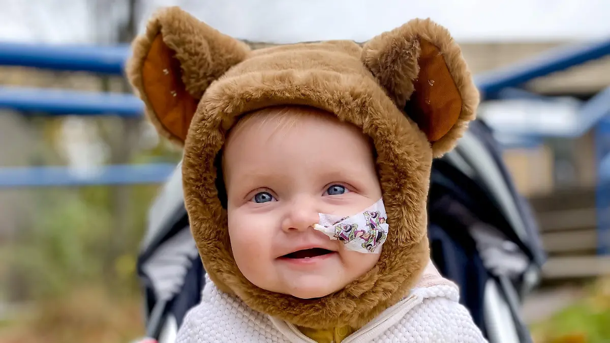 SONDERKONDITIONEN: Satzpreis!
Ted Neal.  A baby boy has had a heartbreaking diagnosis of a rare cancer after parents thought he had sand in his eye.  See SWNS story SWMDeye.  The boys parents believed it was nothing more than sand in his eye from a recent family holiday to Wales, but were shocked to discover their sons more sinister illness.  Ted Neal, 11 months old, has since been diagnosed with a tumor in his sinus, something which doctors are calling a rare case.   His devastated parents, Jessica and Lee Neal, from Nottinghamshire, first noticed the issue in August, immediately taking Ted to A and E.  / action press
