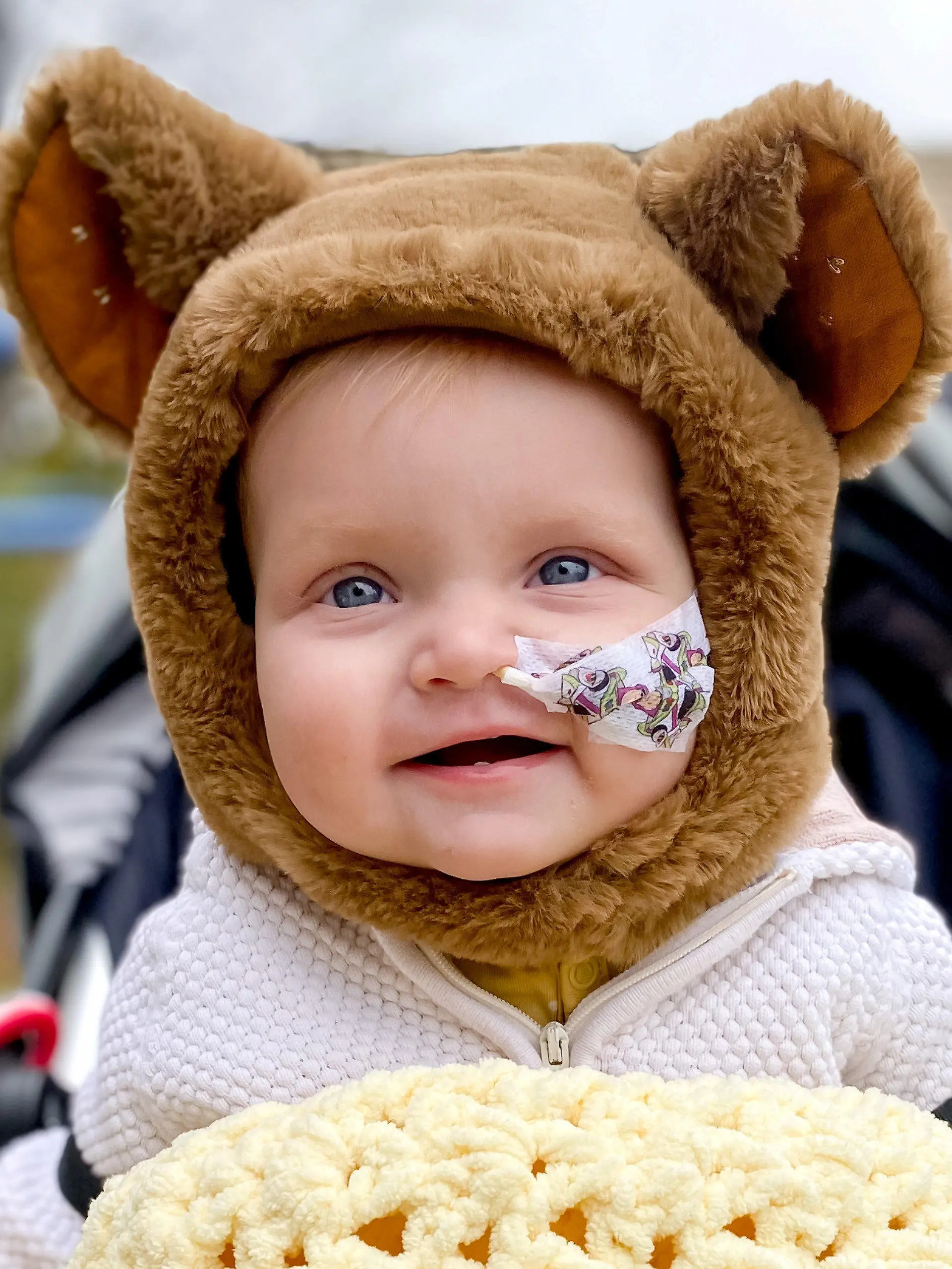 SONDERKONDITIONEN: Satzpreis!
Ted Neal.  A baby boy has had a heartbreaking diagnosis of a rare cancer after parents thought he had sand in his eye.  See SWNS story SWMDeye.  The boys parents believed it was nothing more than sand in his eye from a recent family holiday to Wales, but were shocked to discover their sons more sinister illness.  Ted Neal, 11 months old, has since been diagnosed with a tumor in his sinus, something which doctors are calling a rare case.   His devastated parents, Jessica and Lee Neal, from Nottinghamshire, first noticed the issue in August, immediately taking Ted to A and E.  / action press