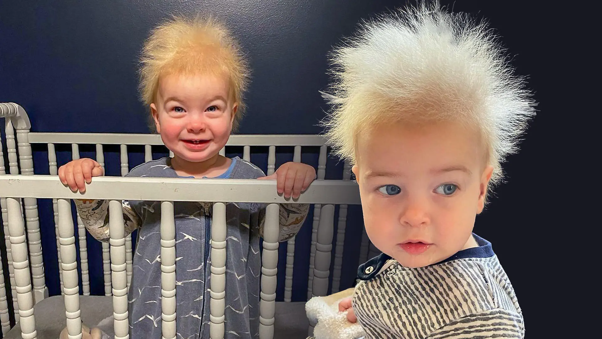 Der einjährige Locklan aus Georgia (USA) leidet am "Struwwelpeter-Syndrom".