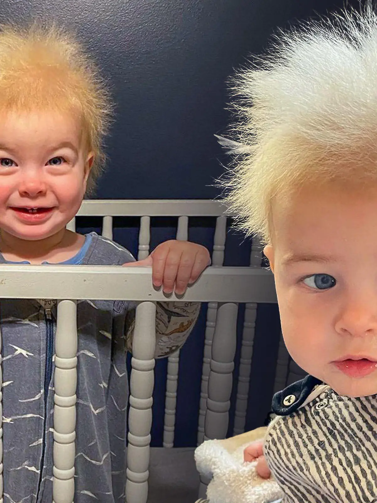 Der einjährige Locklan aus Georgia (USA) leidet am "Struwwelpeter-Syndrom".
