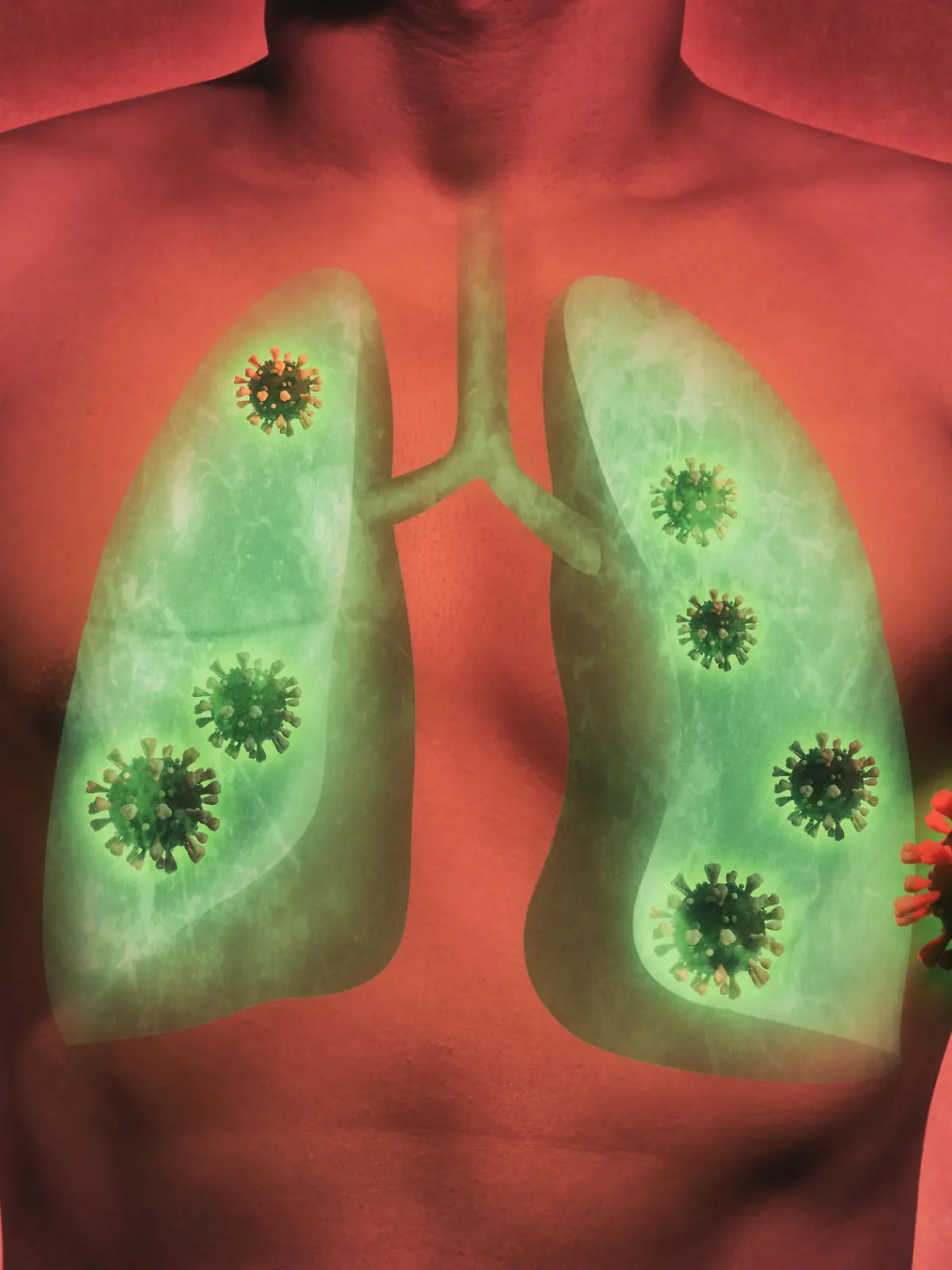 illustrative image of lung damage by coronavirus covid-19. Human anatomy. Concept