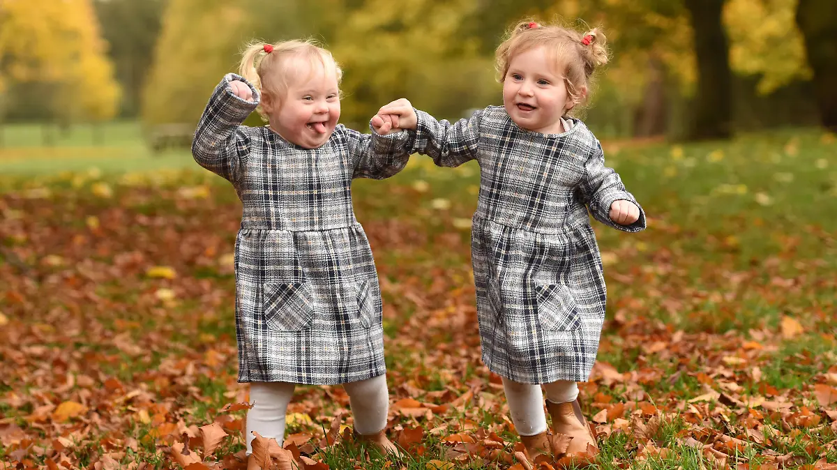 WILLIAM LAILEY / CATERS NEWS (PICTURED L-R Freya and Caitlyn together) A little girl who was born with Down Syndrome has taken her first steps thanks to her twin sister. Laura Guilliatt, 32, from Gainsborough, Lincs, gave birth to her twin girls, Freya and Caitlyn, now two, on 29 September 2019 after five years of struggling to conceive and deciding to opt for IVF. After an emergency C-section at 35 weeks pregnant, Freya was born with Down Syndrome and Caitlyn was not, which is thought to be 14 in one million chance with non-identical twins. As the twins got older, Caitlyn began crawling and walking a few months before her twin sister and would constantly encourage and help her to progress. SEE CATERS COPY