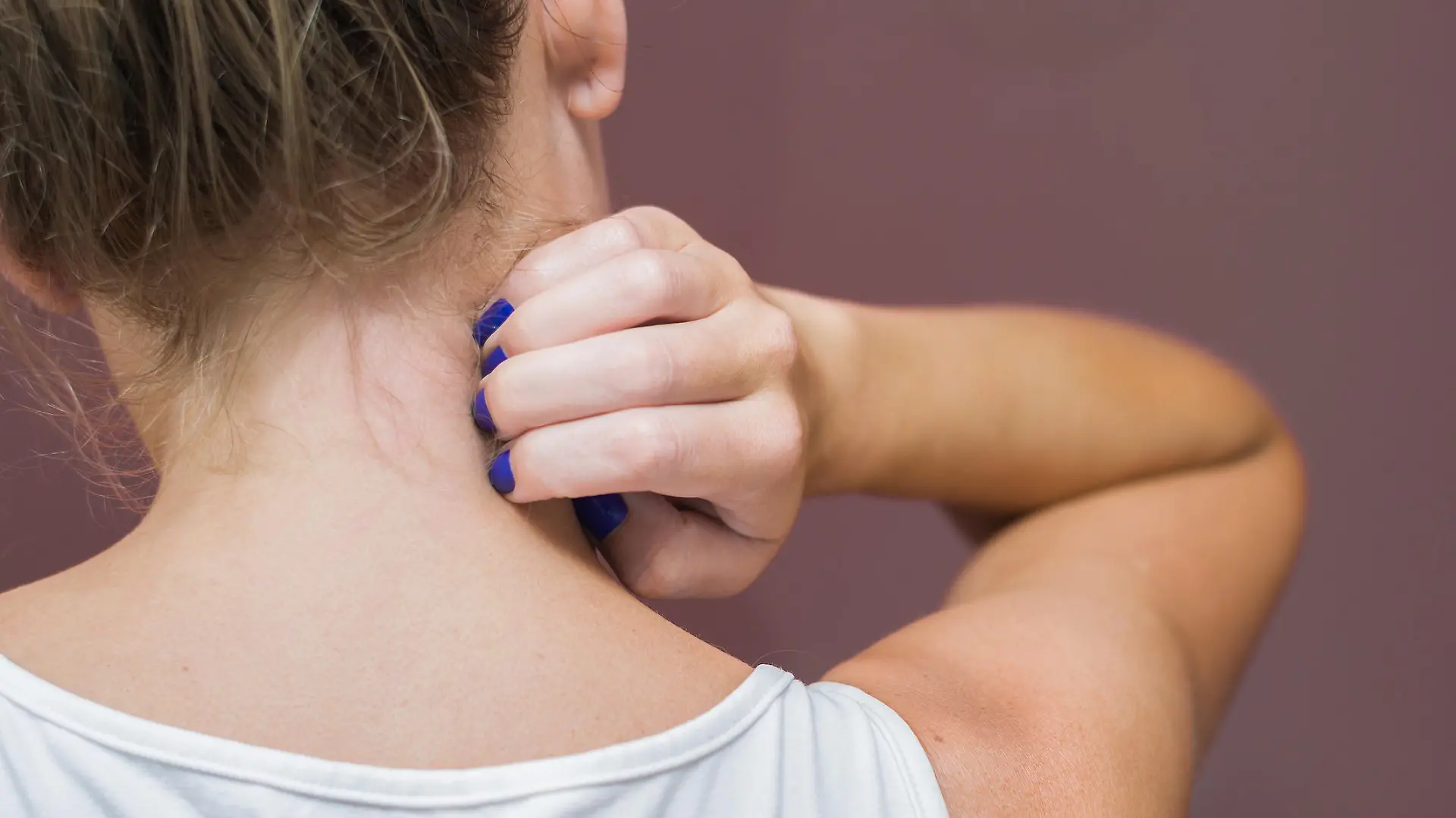 Great concept of allergy and skin diseases, young woman scratching herself.
