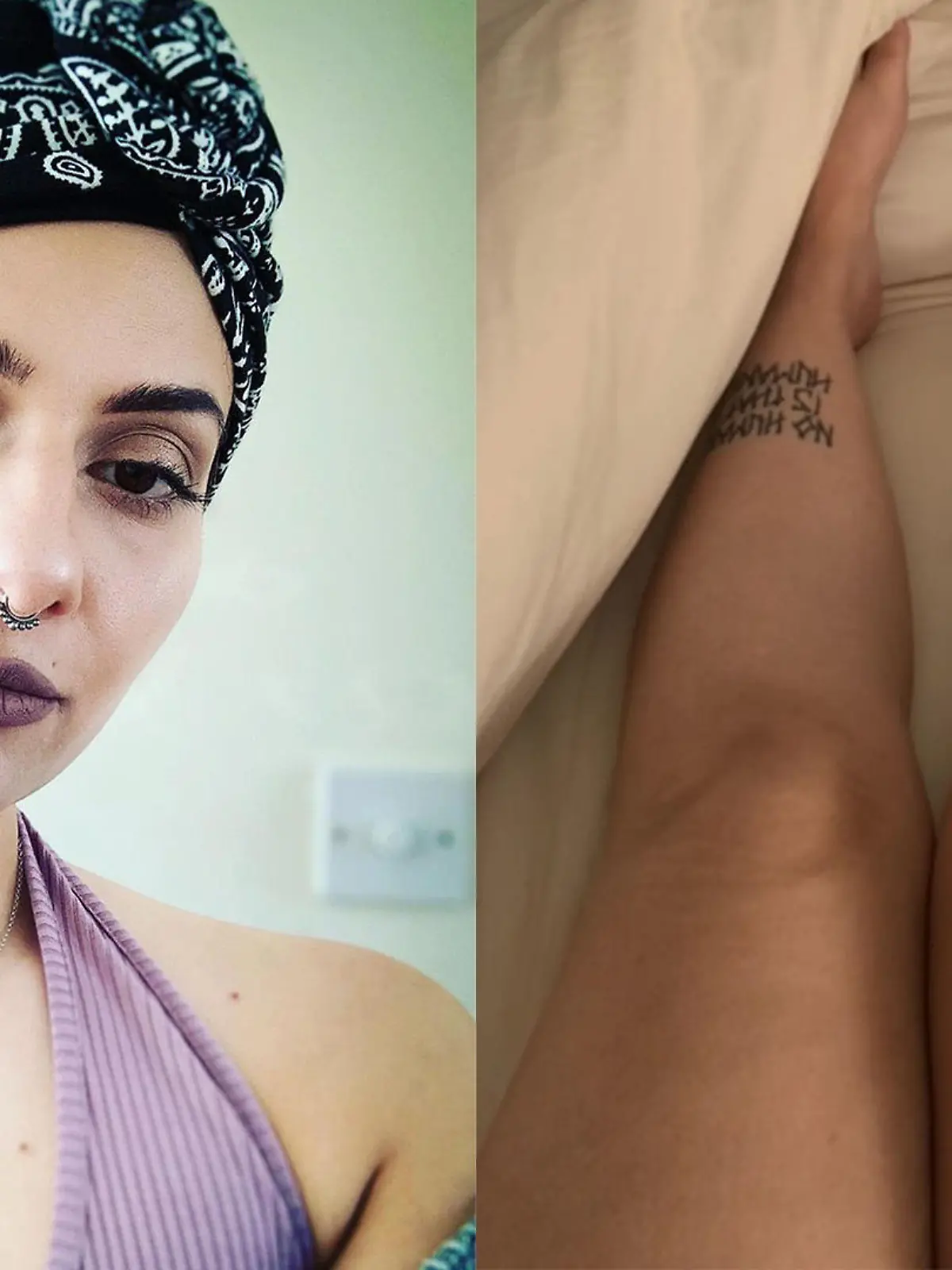 Joanna macht ein Selfie mit einem Turban auf dem Kopf und man sieht das angeschwollene Knie.