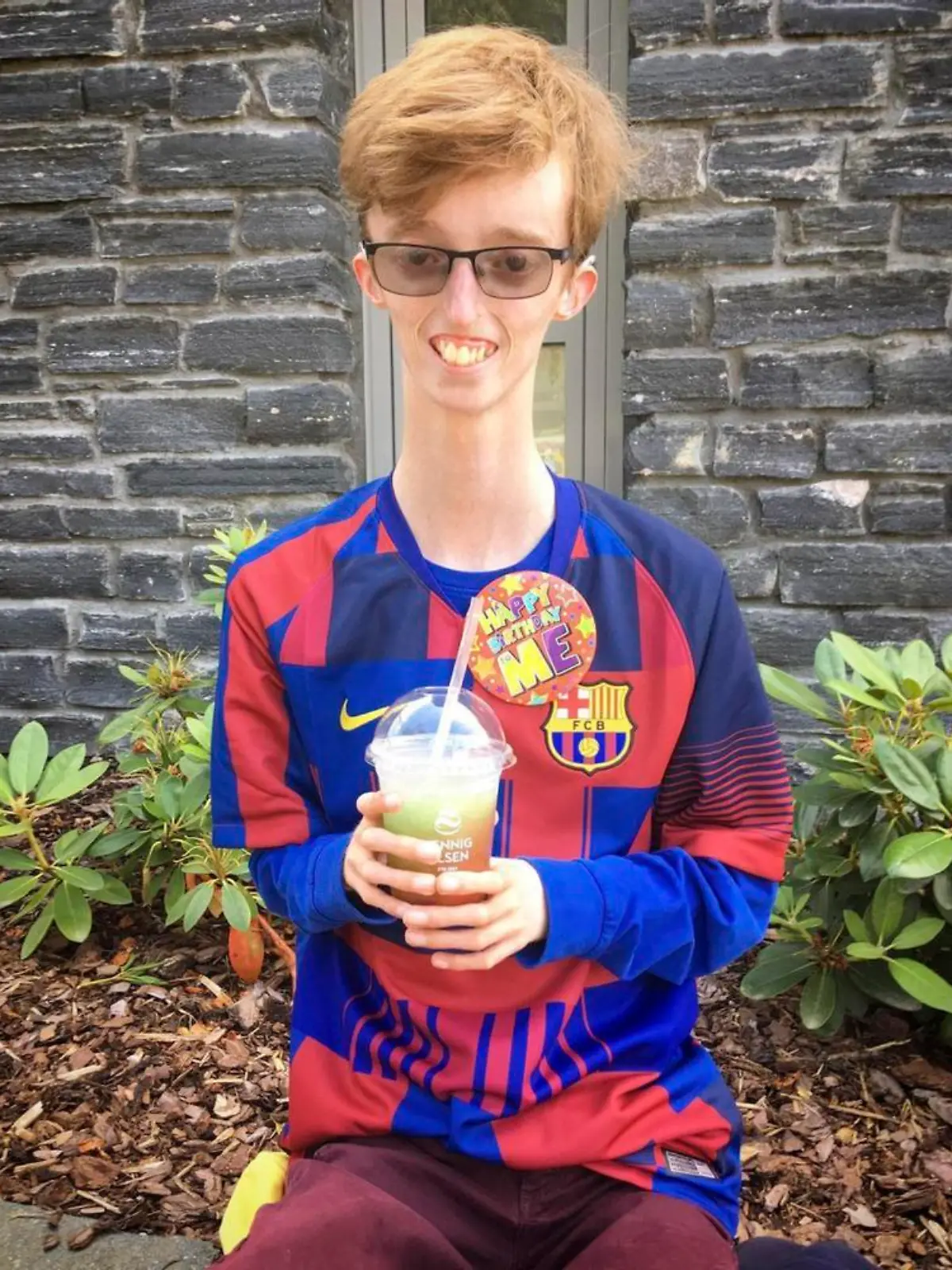 Dylan Lombard / CATERS NEWS - (PICTURED Dylan ) A Scottish teenager has opened up about his life with an ultra rare condition - which affects just 13 people worldwide - as his body is unable to store fat. Dylan Lombard, 18, from Glasgow, Scotland, was diagnosed with MDP -  Mandibular Hypoplasia, with Deafness and Progeroid Features - when he was 18 months old. The condition - which affects just one in six-hundred-million people worldwide - prevents fatty tissue from being stored underneath the skin, and results in a small lower jaw, ears, deafness and tightening of the skin. Dylan said: "I was born with this condition, but it did not become visible until I was 18 months old.SEE CATERS COPY