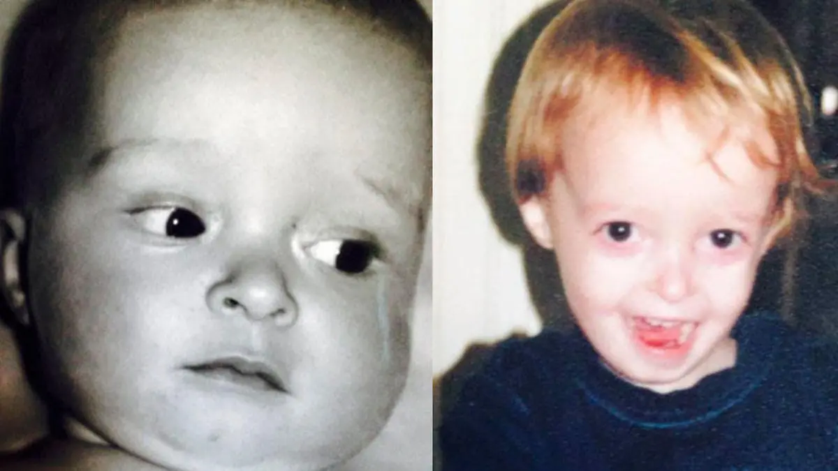 Seine Mutter sah, wie Dylan stark abnahm, und war verständlicherweise sehr besorgt. Es dauerte 10 Jahre, bis die Ärzte die Diagnose stellten.