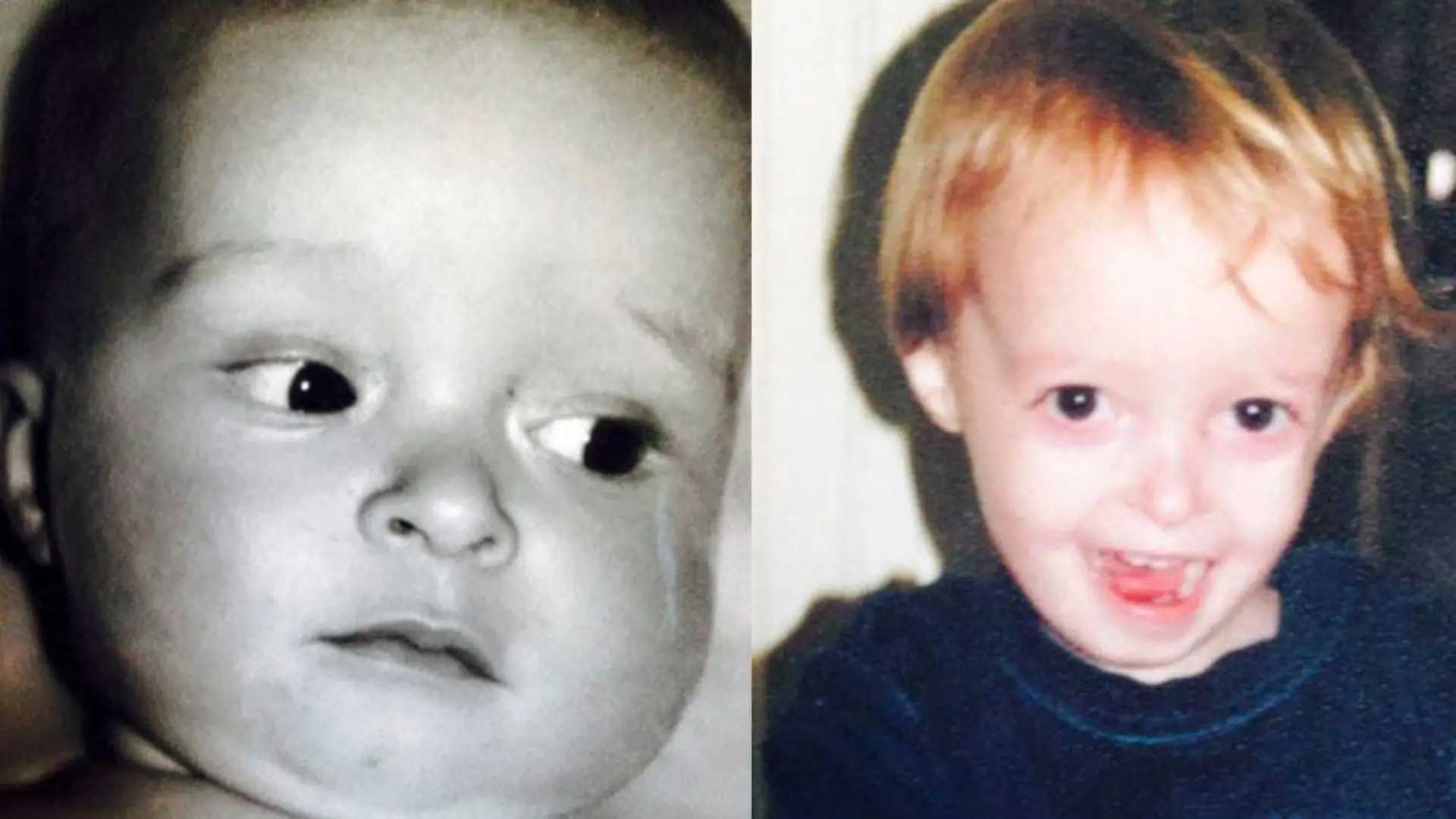 Seine Mutter sah, wie Dylan stark abnahm, und war verständlicherweise sehr besorgt. Es dauerte 10 Jahre, bis die Ärzte die Diagnose stellten.