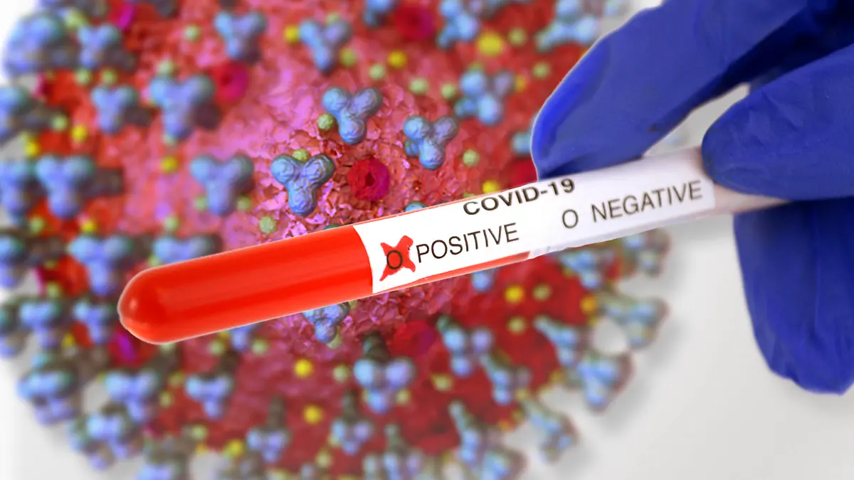 09.10.2020, Symbolbild Corona-Test, Positives Testergebnis. Hintergrund-Grafik, Corona-Virus Mikroskopische Ansicht, 3D-Grafik: Sofiane Regragui 09.10.2020, Symbolbild Corona-Test 09.10.2020, Symbolbild Corona-Test *** 09 10 2020, Symbol image Corona test, Positive test result Background graphic, Corona virus Microscopic view, 3D graphic Sofiane Regragui 09 10 2020, Symbol image Corona test 09 10 2020, Symbol image Corona test
