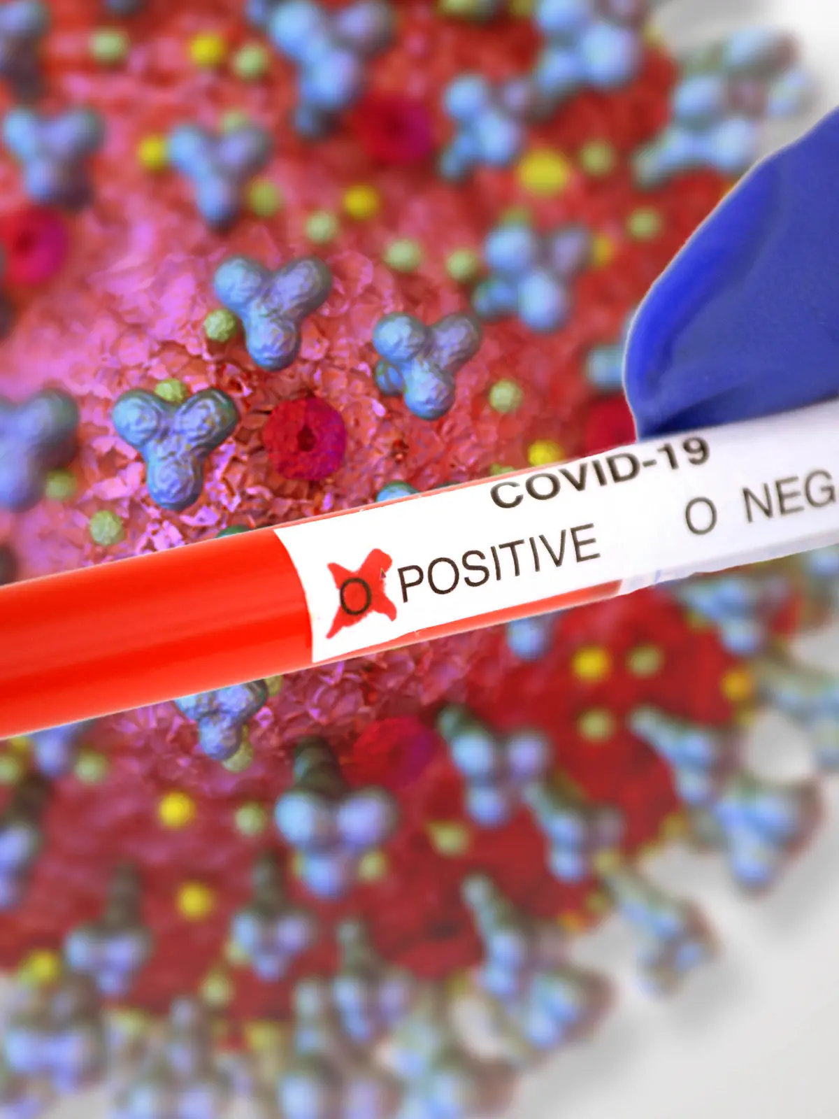  09.10.2020, Symbolbild Corona-Test, Positives Testergebnis. Hintergrund-Grafik, Corona-Virus Mikroskopische Ansicht, 3D-Grafik: Sofiane Regragui 09.10.2020, Symbolbild Corona-Test 09.10.2020, Symbolbild Corona-Test *** 09 10 2020, Symbol image Corona test, Positive test result Background graphic, Corona virus Microscopic view, 3D graphic Sofiane Regragui 09 10 2020, Symbol image Corona test 09 10 2020, Symbol image Corona test