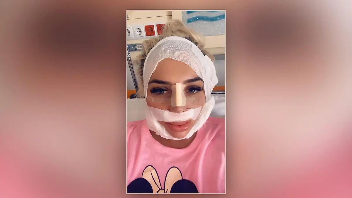 Amber May nach einer Operations