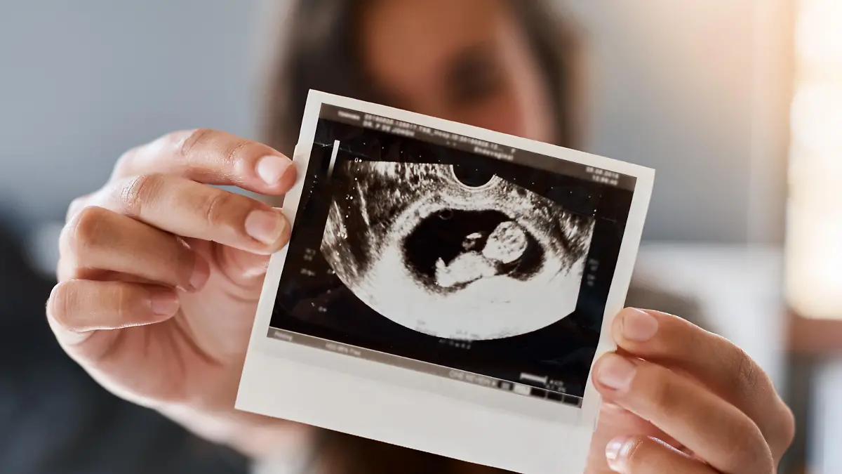 Shot of a woman holding a sonogram of her unborn baby
