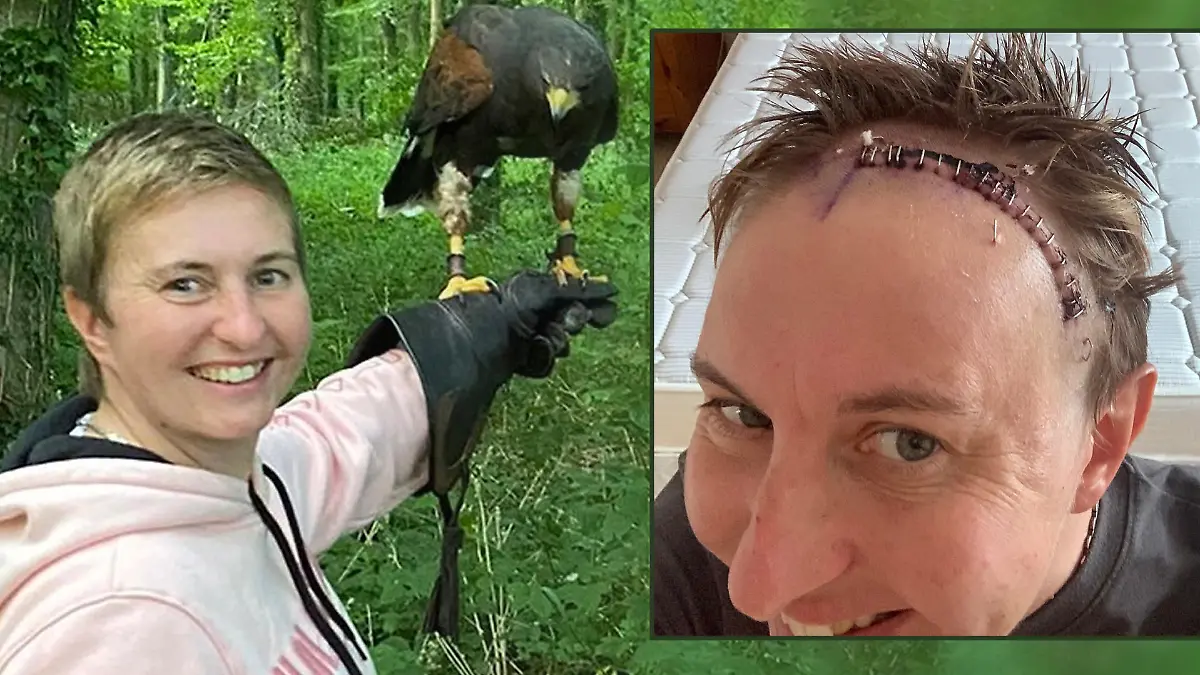 Bösartiger Tumor anstatt Corona-Infektion: Jenny Weller bekommt eine niederschmetternde Diagnose.