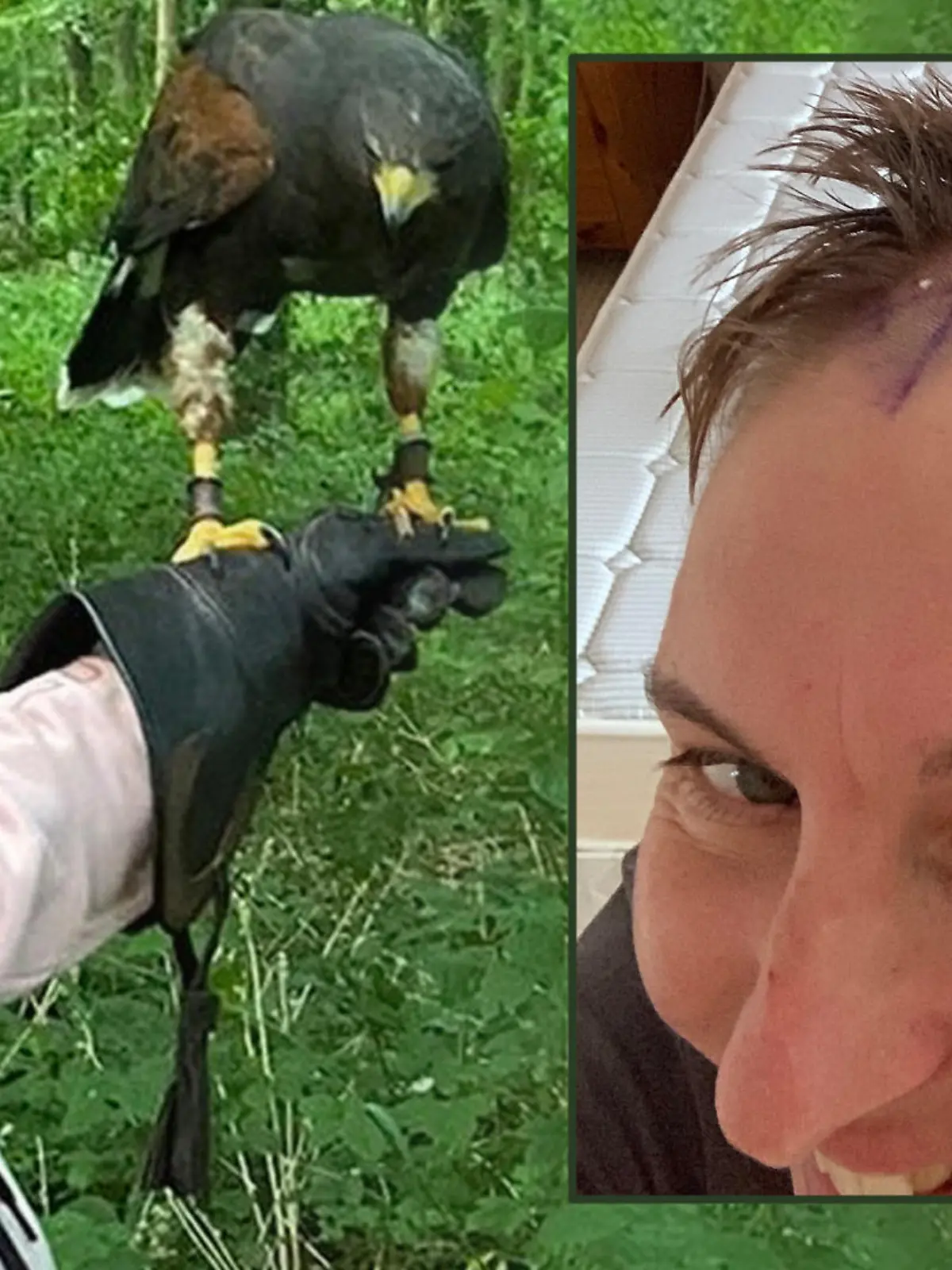 Bösartiger Tumor anstatt Corona-Infektion: Jenny Weller bekommt eine niederschmetternde Diagnose.