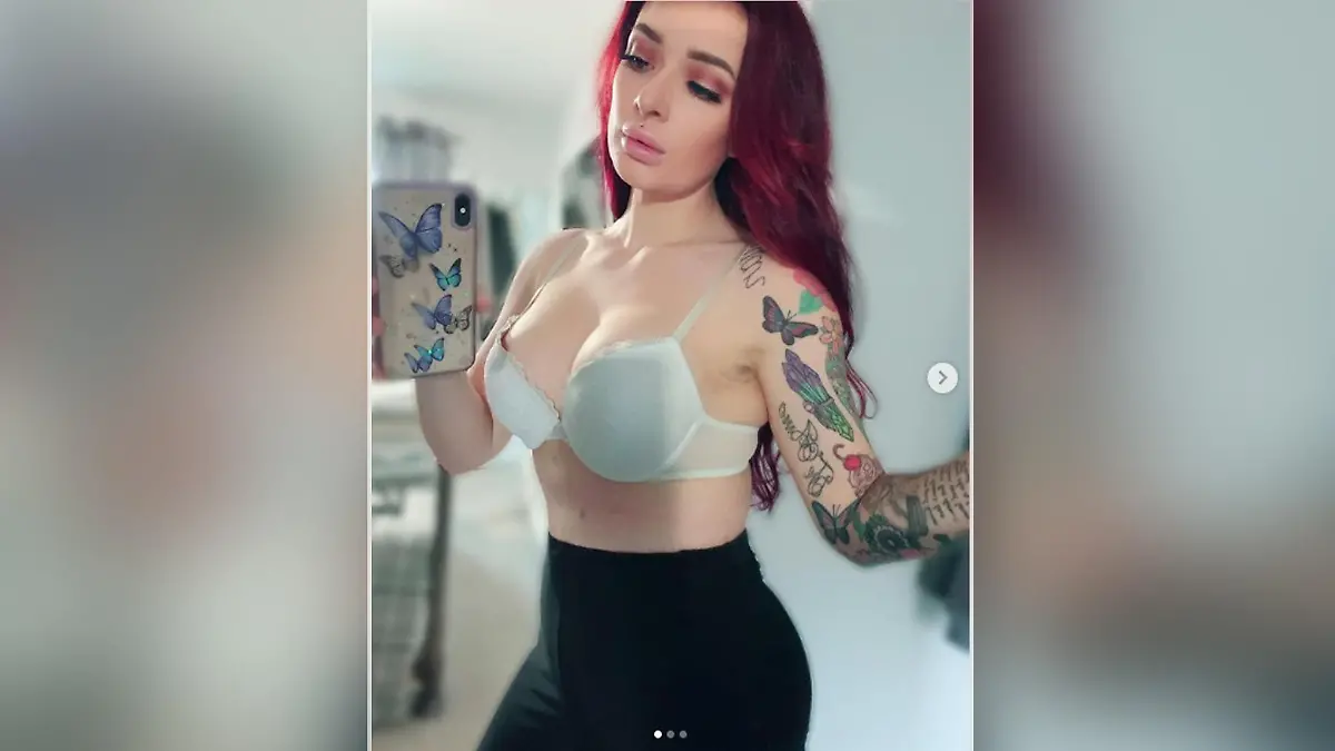 Mithilfe verschiedener Operationen hat es Kayleigh geschafft, sich endlich wieder wohlzufühlen in ihrem Körper.