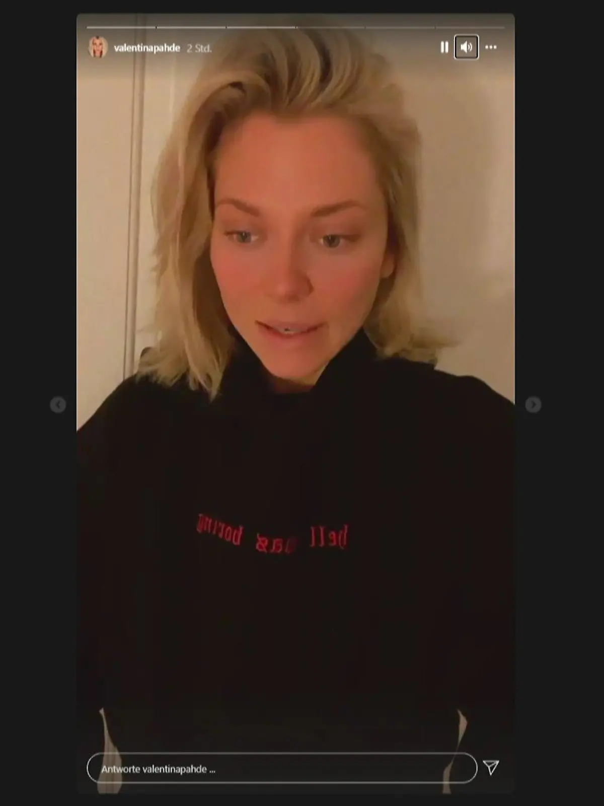 Valentina Pahde hat bei Instgram verkündet, dass sie wegen einer Verletzung an der Rippe nicht weiter tanzen darf und sich schonen muss. Ob sie vielleicht einen netten Pfleger namens Rúrik hat?