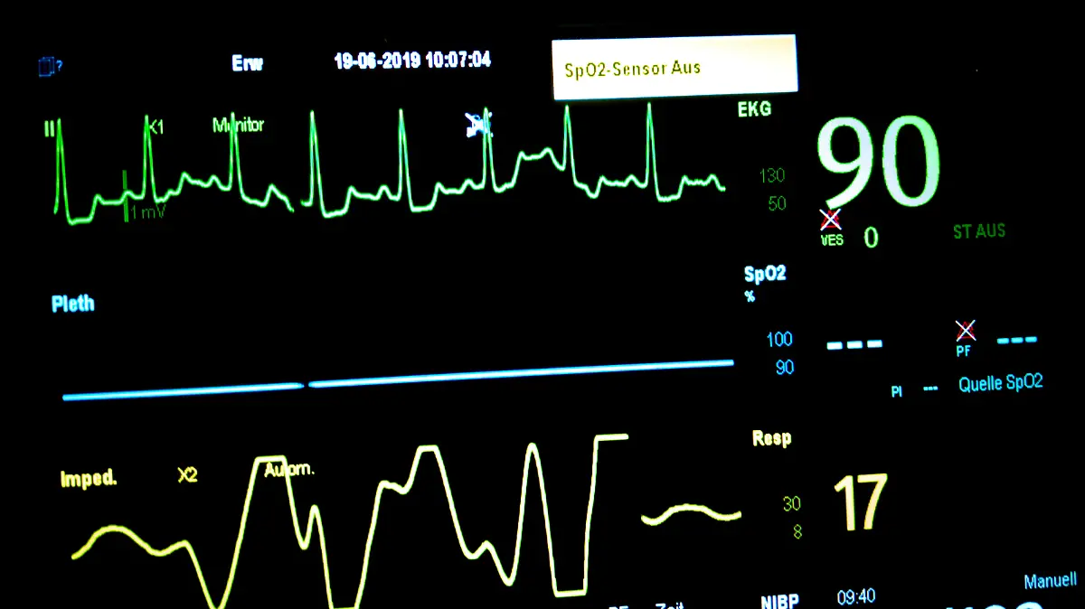ECG with high blood pressure and high heart rate