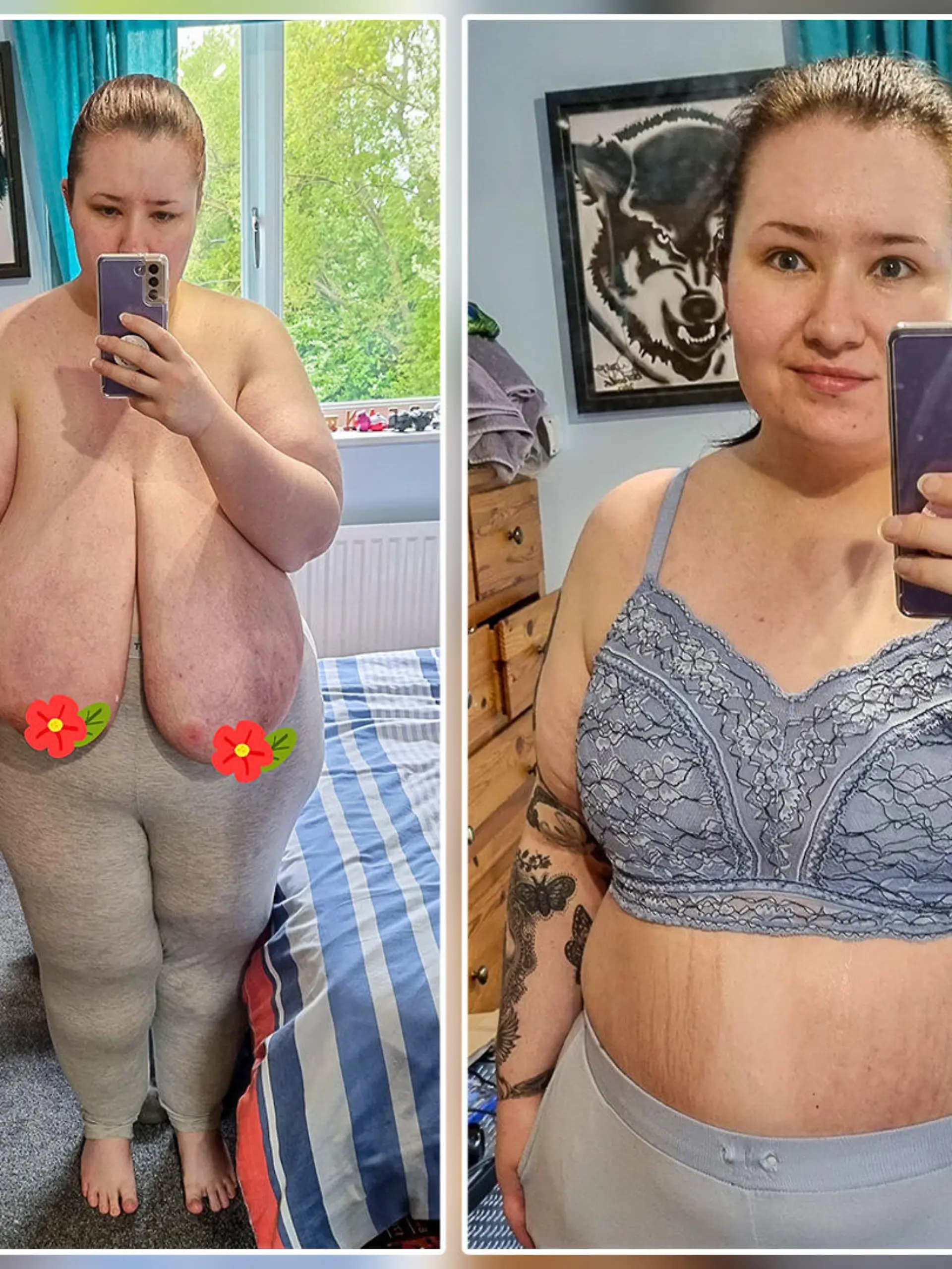 Laura Howes vor und nach der OP