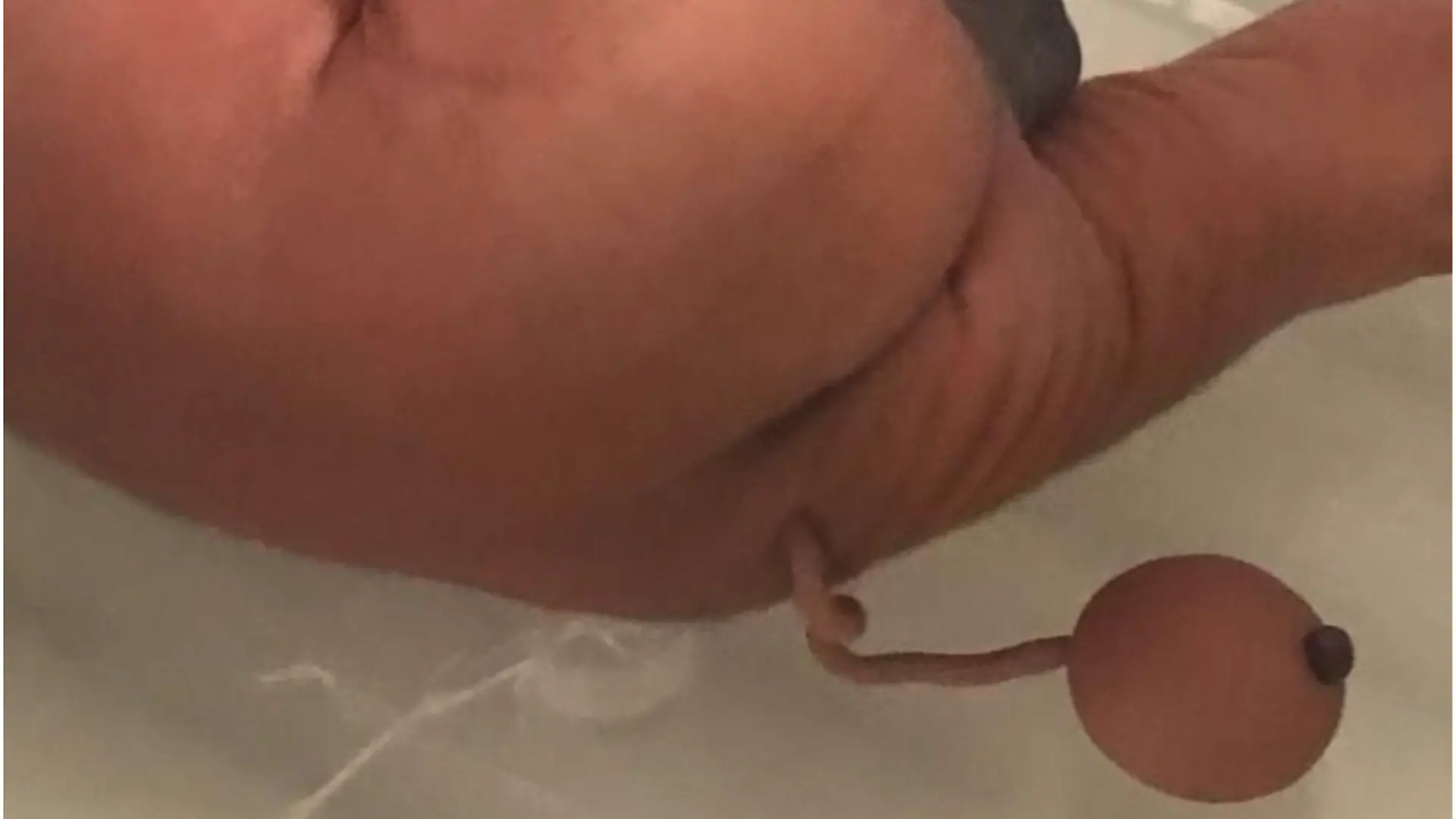 Baby mit Schwanz geboren