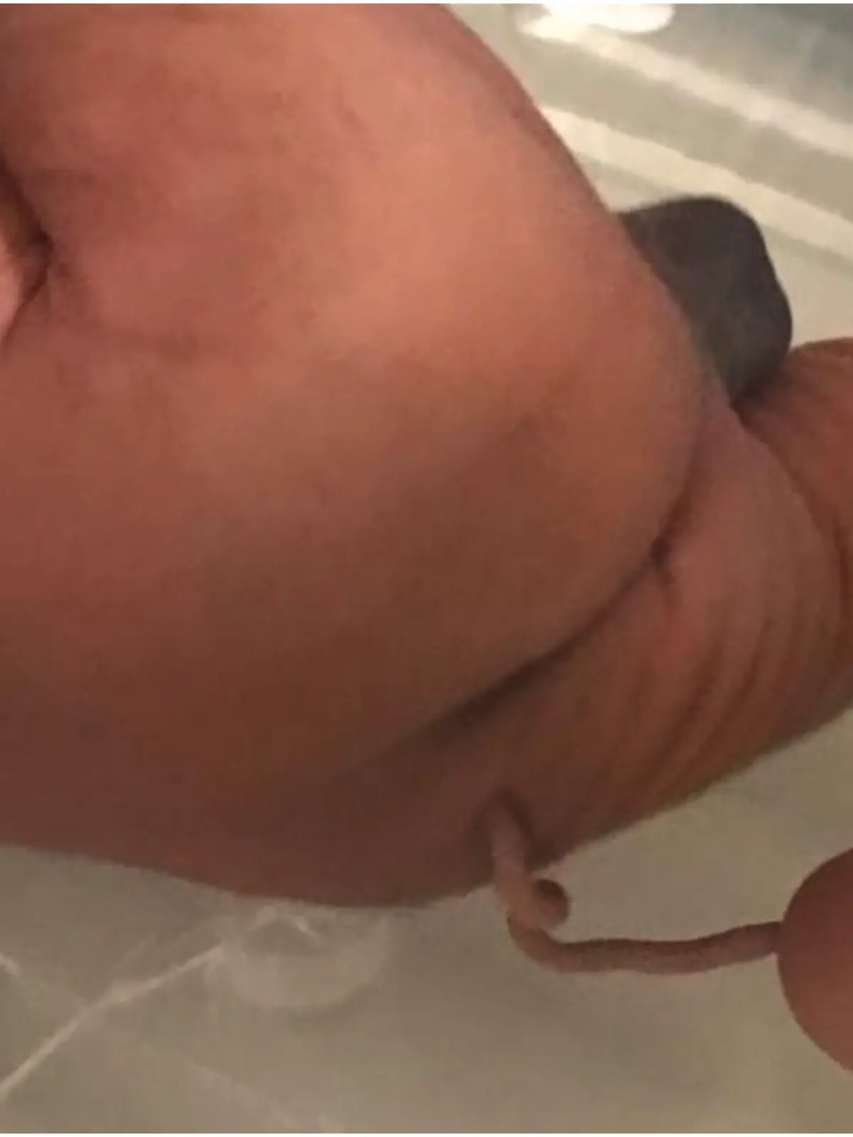 Baby mit Schwanz geboren