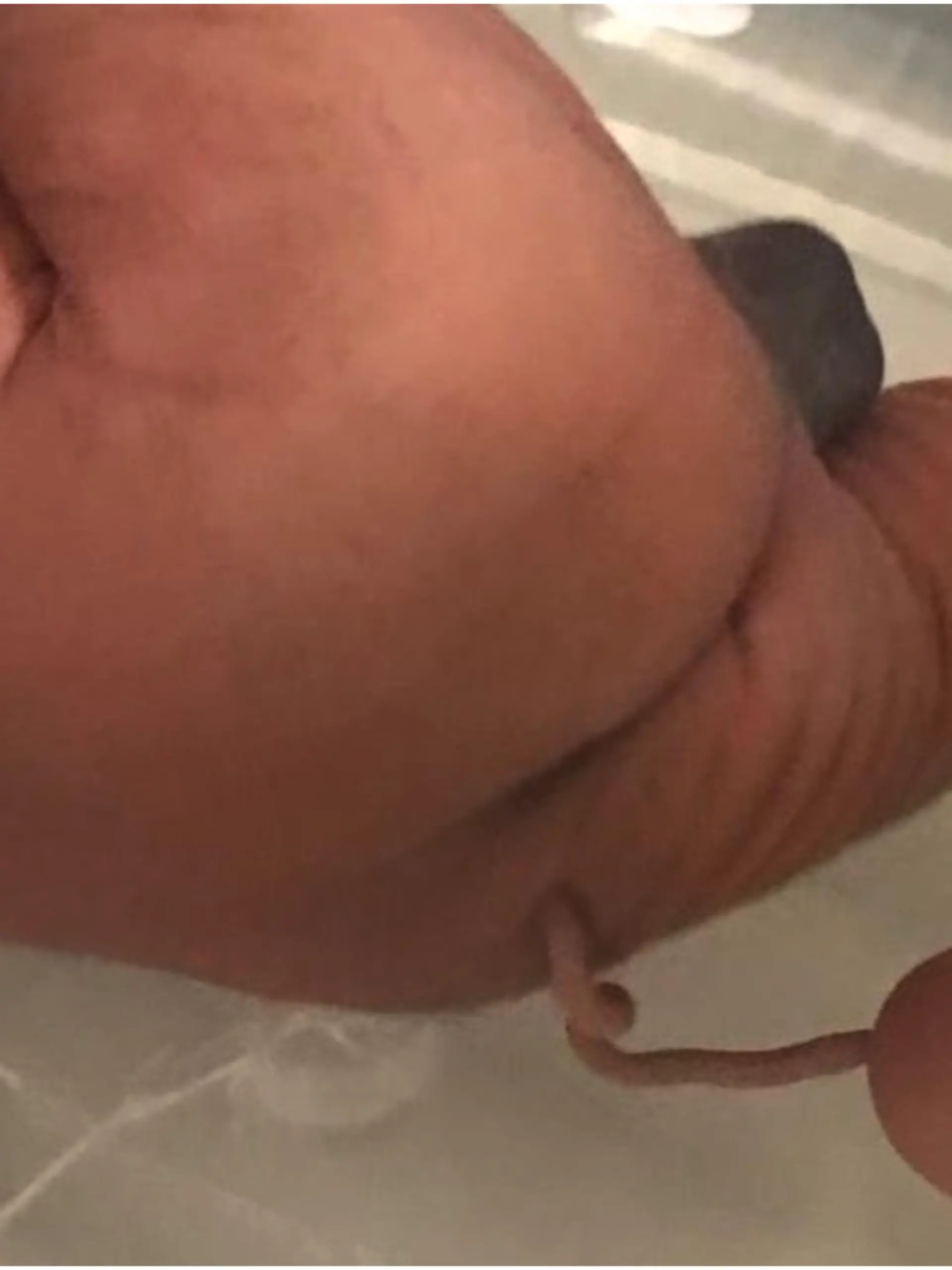 Baby mit Schwanz geboren