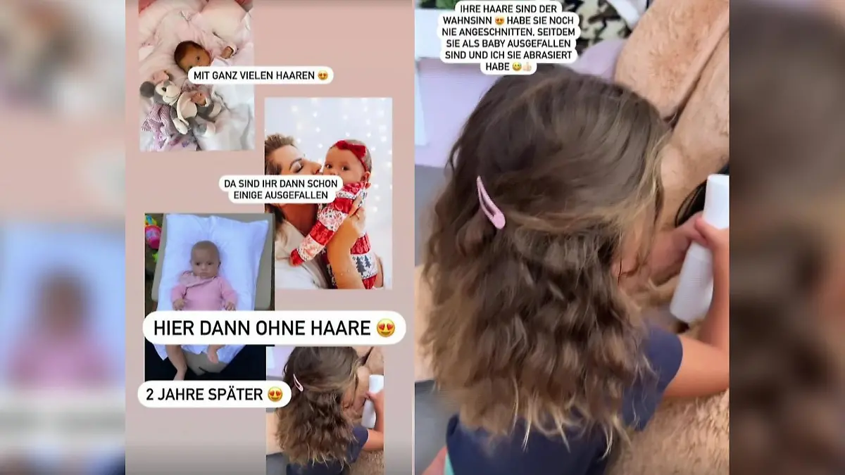 Sarah Harrison zeigt, wie Tochter Kayla als Baby mit absraierten Haaren aussah - und wie sie heute aussieht.