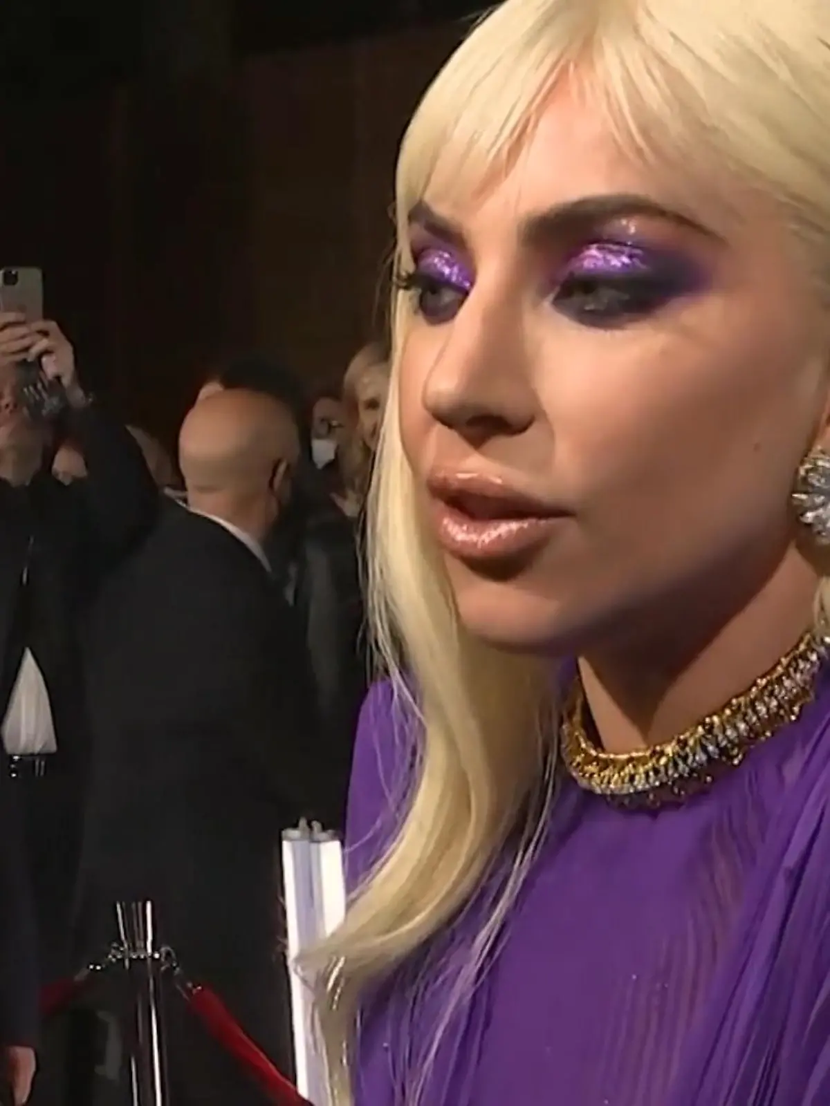 Bild zu: "So sehr litt Lady Gaga beim Dreh"