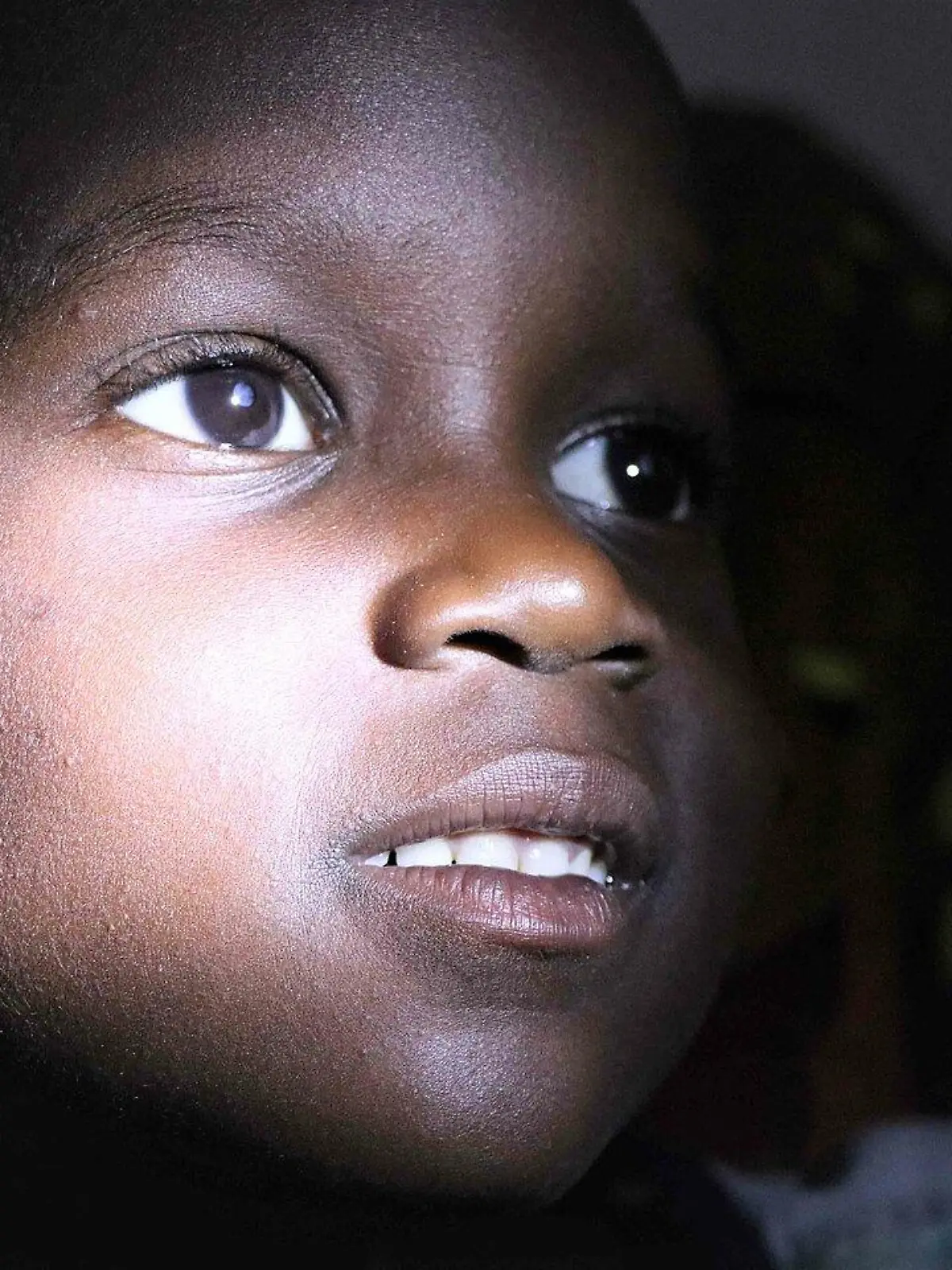 In Uganda kommen auf 43 Millionen Einwohner nur sechs Kinderaugenärzte.
