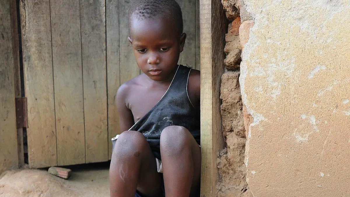 Kinder mit Sehbehinderung in Uganda brauchen dringend eine bessere medizinische Versorgung
