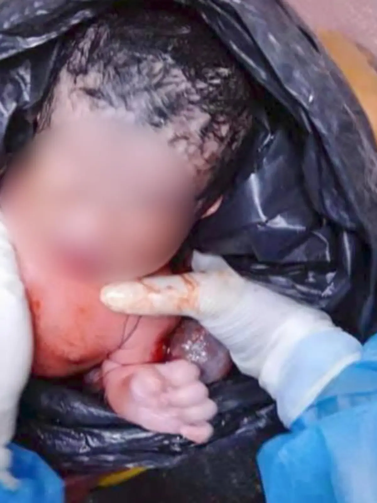 Dieses Bild zerreißt einem das Herz. In Thailand ist ein neugeborenes Mädchen am Straßenrand ausgesetzt worden - in einem Müllbeutel verpackt. Eine 62-Jährige und ihre Tochter hörten Schreie und fanden das Baby neben einer blauen Plastiktonne.