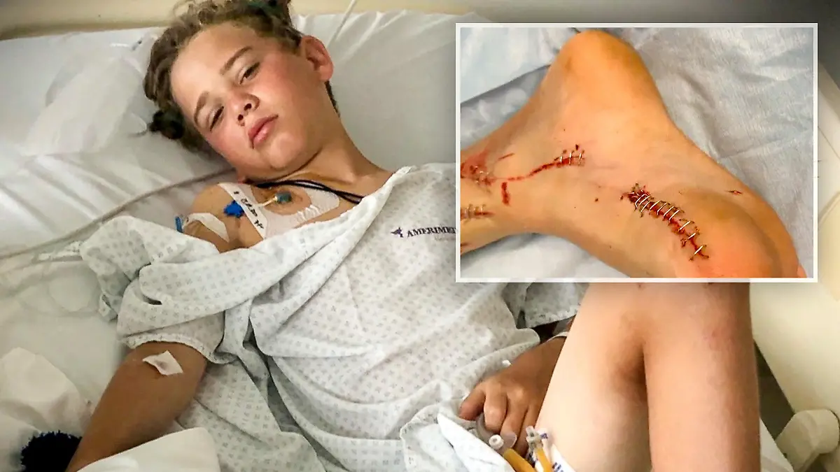 Charlie (12): So überlebte ich einen Krokodilangriff Während eines Urlaubs in Mexiko