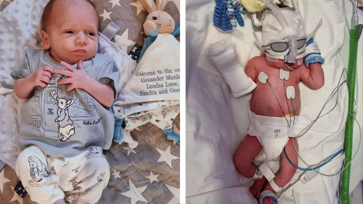 SONDERKONDITIONEN: Satzpreis!
(L-R) Alexander James Manley on his due date (24th May) vs the day he was actually born (6th April). See SWNS story SWSYjam. A mum said her son owes his life to a hospital breakfast of jam on toast she ate while in labour -- after it sparked life-saving tests. Robyn Banson-Noond, 31, was in hospital after her waters broke at 32 weeks, but was preparing to go home to let her labour progress naturally, she said. But she tucked into a brekkie of sugary strawberry jam on toast - which caused a huge spike in her blood sugar levels, worrying the docs. Mum Robyn was healthy - but the tests inadvertently revealed unborn son Alexander James Manley was being strangled by his umbilical cord and his heart rate was plunging. / action press