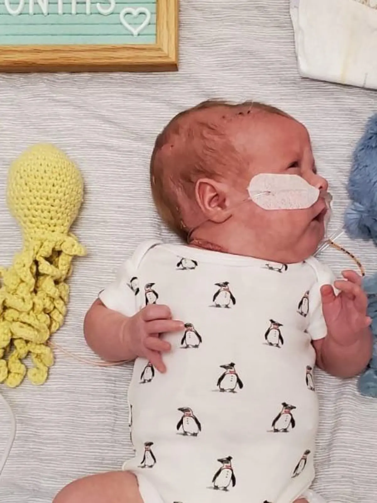 Theodore Jude kam in der 25. Schwangerschaftswoche zur Welt, nachdem seine Mutter attackiert wurde.