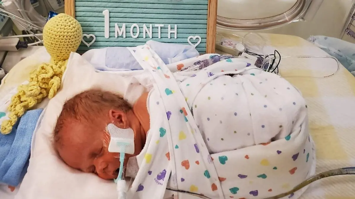 Theodore (hier ein Monat alt) wog nur knapp 1000 g bei seiner Geburt.