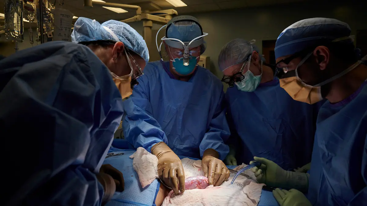 HANDOUT - 25.09.2021, USA, New York: Auf diesem Foto vom September 2021, das von NYU Langone Health zur Verfügung gestellt wurde, untersucht ein Chirurgenteam in einem Krankenhaus eine Schweineniere, die am Körper eines Verstorbenen befestigt ist, auf Anzeichen einer Abstoßung. Von links: Dr. Zoe A. Stewart-Lewis, Robert A. Montgomery, Bonnie E. Lonce und Jeffrey Stern. Ein New Yorker Transplantationsteam hat eigenen Angaben zufolge erstmals eine Schweineniere für mehr als zwei Tage an einen menschlichen Organismus angeschlossen. Das Organ sei für 54 Stunden außerhalb des Körpers am Bein einer hirntoten Person mit dem Blutkreislauf verbunden worden und habe dort «fast sofort» angefangen zu arbeiten und das Stoffwechselprodukt Kreatinin zu bilden. (Zu dpa "Berichte: Schweineniere erfolgreich an einen Menschen angeschlossen") Foto: Joe Carrotta/NYU Langone Health/AP/dpa - ACHTUNG: Nur zur redaktionellen Verwendung im Zusammenhang mit der aktuellen Berichterstattung und nur mit vollständiger Nennung des vorstehenden Credits +++ dpa-Bildfunk +++