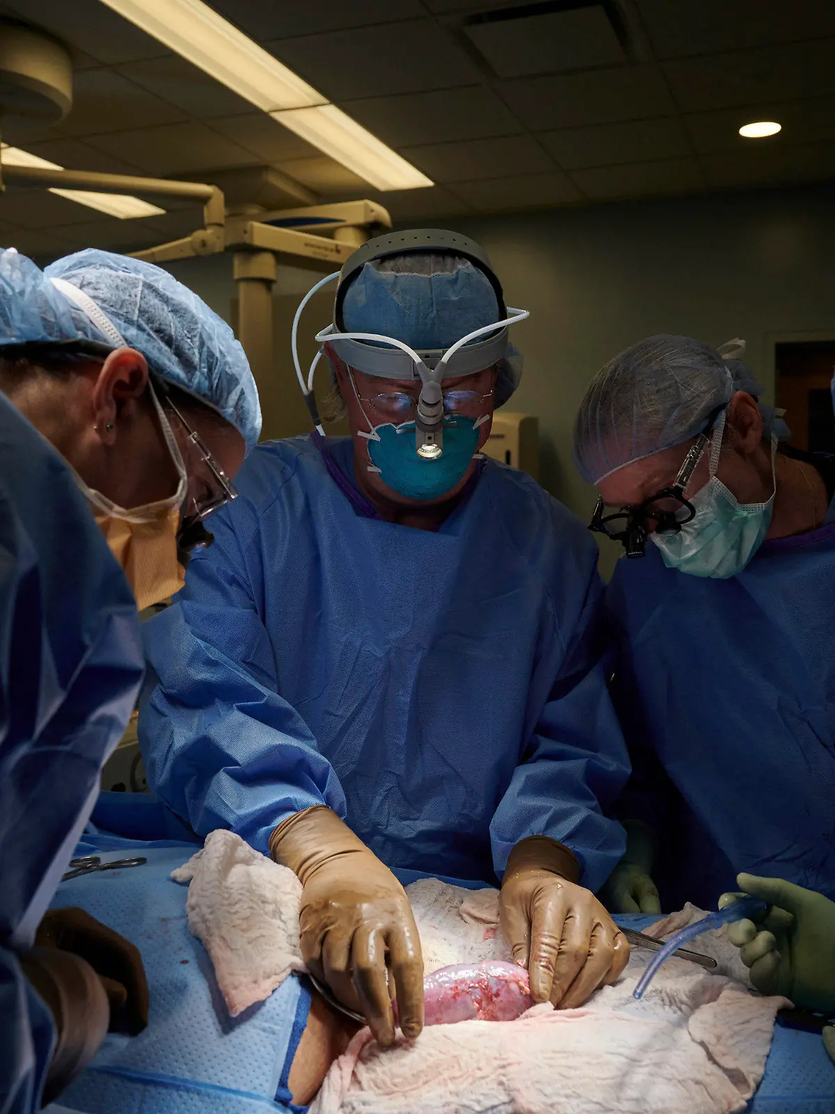 HANDOUT - 25.09.2021, USA, New York: Auf diesem Foto vom September 2021, das von NYU Langone Health zur Verfügung gestellt wurde, untersucht ein Chirurgenteam in einem Krankenhaus eine Schweineniere, die am Körper eines Verstorbenen befestigt ist, auf Anzeichen einer Abstoßung. Von links: Dr. Zoe A. Stewart-Lewis, Robert A. Montgomery, Bonnie E. Lonce und Jeffrey Stern. Ein New Yorker Transplantationsteam hat eigenen Angaben zufolge erstmals eine Schweineniere für mehr als zwei Tage an einen menschlichen Organismus angeschlossen. Das Organ sei für 54 Stunden außerhalb des Körpers am Bein einer hirntoten Person mit dem Blutkreislauf verbunden worden und habe dort «fast sofort» angefangen zu arbeiten und das Stoffwechselprodukt Kreatinin zu bilden. (Zu dpa "Berichte: Schweineniere erfolgreich an einen Menschen angeschlossen") Foto: Joe Carrotta/NYU Langone Health/AP/dpa - ACHTUNG: Nur zur redaktionellen Verwendung im Zusammenhang mit der aktuellen Berichterstattung und nur mit vollständiger Nennung des vorstehenden Credits +++ dpa-Bildfunk +++