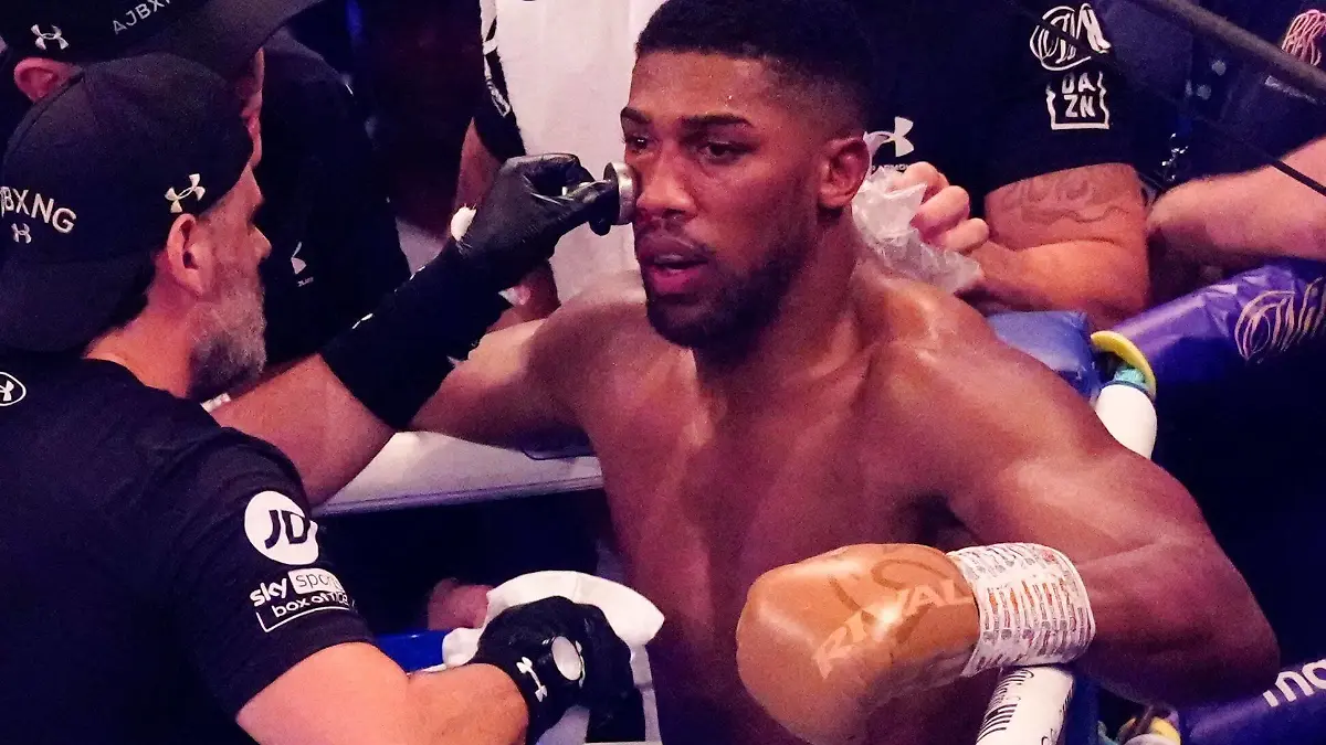 Mandatory Credit: Photo by Dave Shopland/Shutterstock 12463389at Anthony Joshua v Oleksandr Usyk - Joshua gets treatment on the swelling around his right eye Anthony Joshua vs. Oleksandr Usyk & Undercard, Boxing, Tottenham Hotspur Stadium, London, UK - 25 Sep 2021 Anthony Joshua vs. Oleksandr Usyk & Undercard, Boxing, Tottenham Hotspur Stadium, London, UK - 25 Sep 2021 PUBLICATIONxINxGERxSUIxAUTXHUNxGRExMLTxCYPxROMxBULxUAExKSAxONLY Copyright: xDavexShopland/Shutterstockx 12463389at