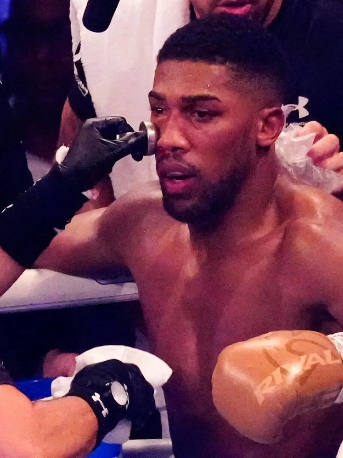  Mandatory Credit: Photo by Dave Shopland/Shutterstock 12463389at Anthony Joshua v Oleksandr Usyk - Joshua gets treatment on the swelling around his right eye Anthony Joshua vs. Oleksandr Usyk & Undercard, Boxing, Tottenham Hotspur Stadium, London, UK - 25 Sep 2021 Anthony Joshua vs. Oleksandr Usyk & Undercard, Boxing, Tottenham Hotspur Stadium, London, UK - 25 Sep 2021 PUBLICATIONxINxGERxSUIxAUTXHUNxGRExMLTxCYPxROMxBULxUAExKSAxONLY Copyright: xDavexShopland/Shutterstockx 12463389at