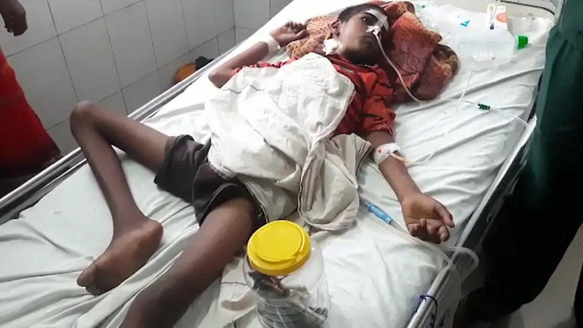 Story from Jam Press (Toothbrushes Stomach)
Pictured: Harish Devi in hospital after the surgery to remove the toothbrushes and nail from his stomach.
Doctors remove 16 TOOTHBRUSHES and IRON NAIL from boy’s STOMACH.
***Warning – graphic photos and videos***
Doctors in India have managed to successfully remove 16 toothbrushes and a three-inch iron nail from a teenage boy’s stomach.
Prior to the surgery, Harish Devi, 14, from the state of Uttar Pradesh, India, had ingested the dental equipment after being advised to by a holistic practitioner saying it would cure his habit of eating soil.
His family also believed Harish had been possessed by a ghost and that consuming toothbrushes and nails would help heal him.
After feeding him the plastic items and metal nail, his family discovered his habit of eating dirt did not go away but the teenager started experiencing pain in his abdomen.
Harish was taken to Baba Raghav Das Medical College, where they discovered he had toothbrushes and a nail in his stomach.
Doctors operated on the 14-year-old and took out 16 toothbrushes and a three-inch nail from his insides.
Following the removal of the foreign objects, Harish’s health has improved and doctors are hopeful he will make a full recovery.
The gruesome photos show snippets from the surgery with some of the toothbrushes being removed from the patient’s stomach.
In the video, one doctor holds up an X-ray to show the large iron nail in the middle of the youngster's body.
Harish can be seen recovering from his surgery on a bed with a box of the toothbrushes taken from his stomach by his side.
ENDS