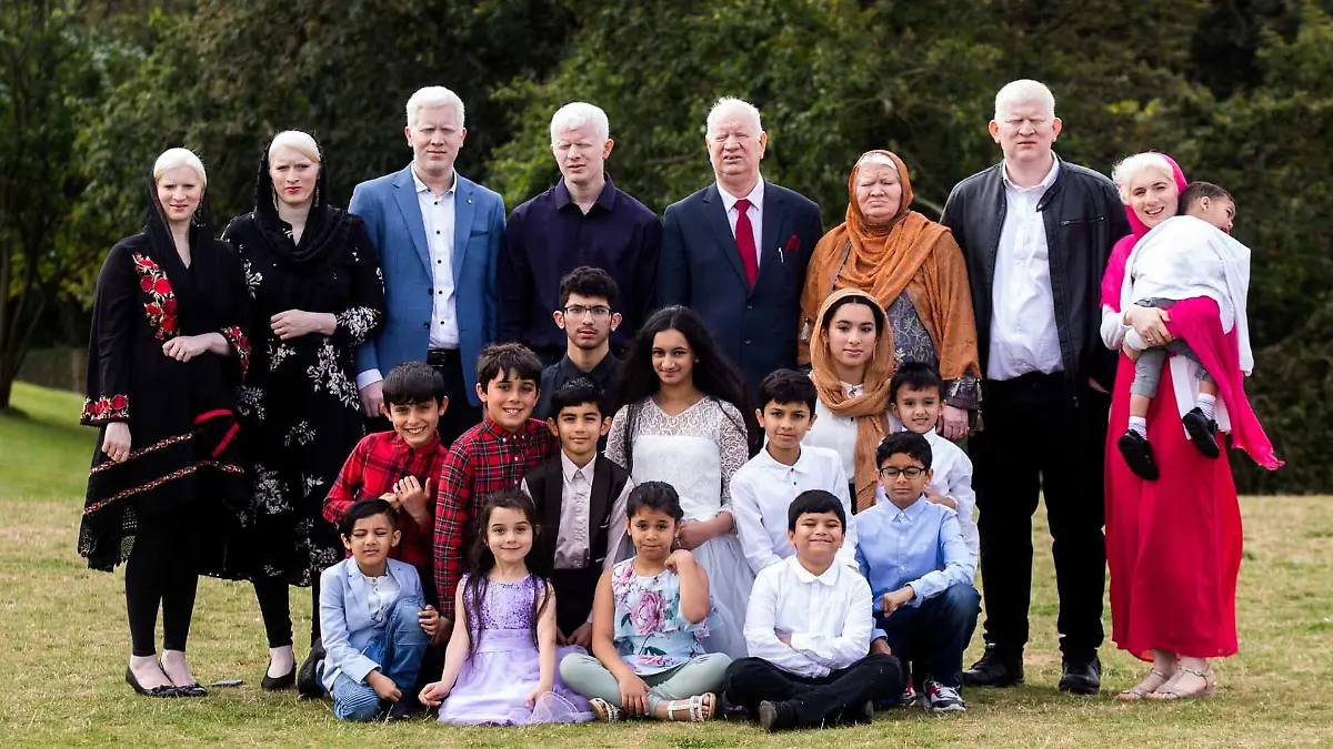 Die Parvez' sind die größte Albino-Familie weltweit.