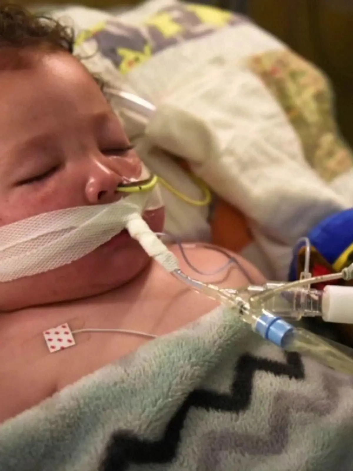 Adrian James (2) muss wegen seiner Corona-Erkrankung künstlich beatmet werden.