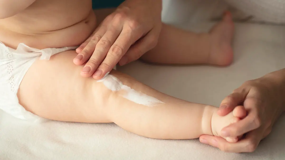 Woman hand holding infant leg. Mother carefully applying medical ointment. Red dry skin allergy from milk formula or other food. Care about baby body. Closeup shot with dslr camera, canon 5dsr