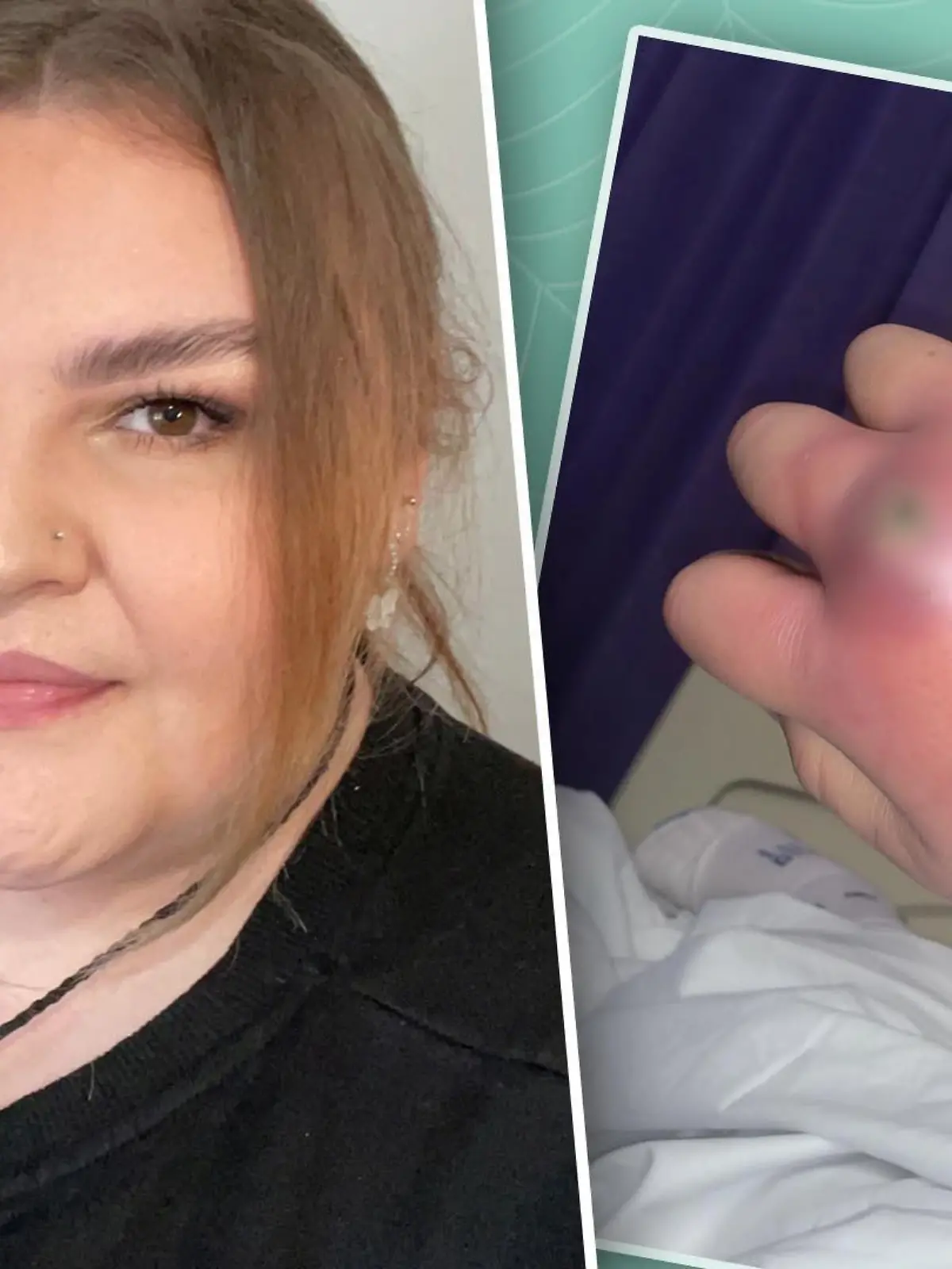 Morgan (21) wachte eines Morgens mit einer juckenden Hand auf - sie wurde im Schlaf von einer Spinne gebissen.